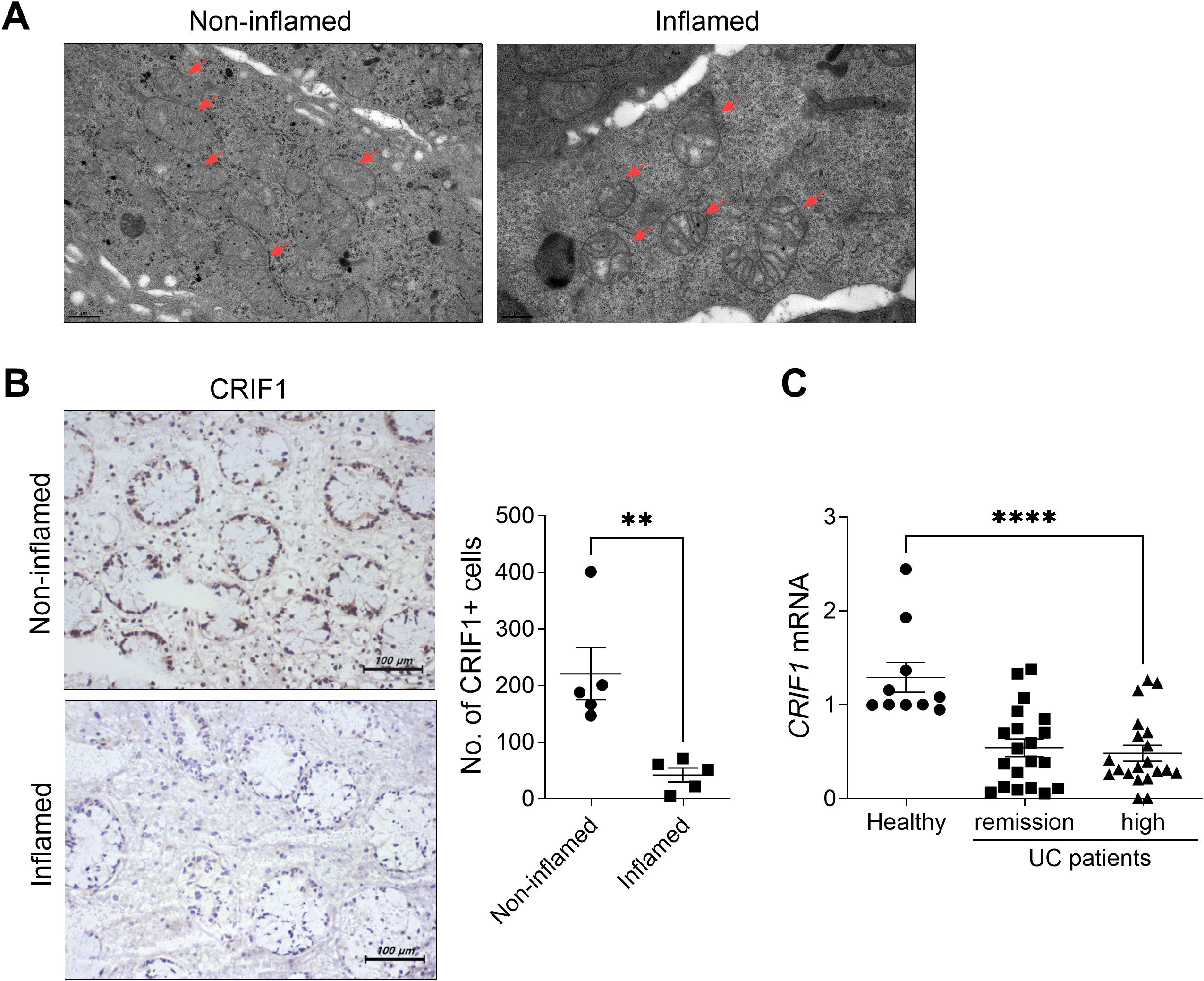 Panel A shows electron microscopy images comparing non-inflamed and inflamed tissues, with arrows indicating specific structures. Panel B contains immunohistochemistry images of CRIF1 expression in non-inflamed and inflamed tissues, and a bar graph indicating a significant decrease in the number of CRIF1-positive cells in inflamed tissue. Panel C displays a graph showing CRIF1 mRNA levels, indicating significant differences between healthy individuals and UC patients in remission and high inflammation.