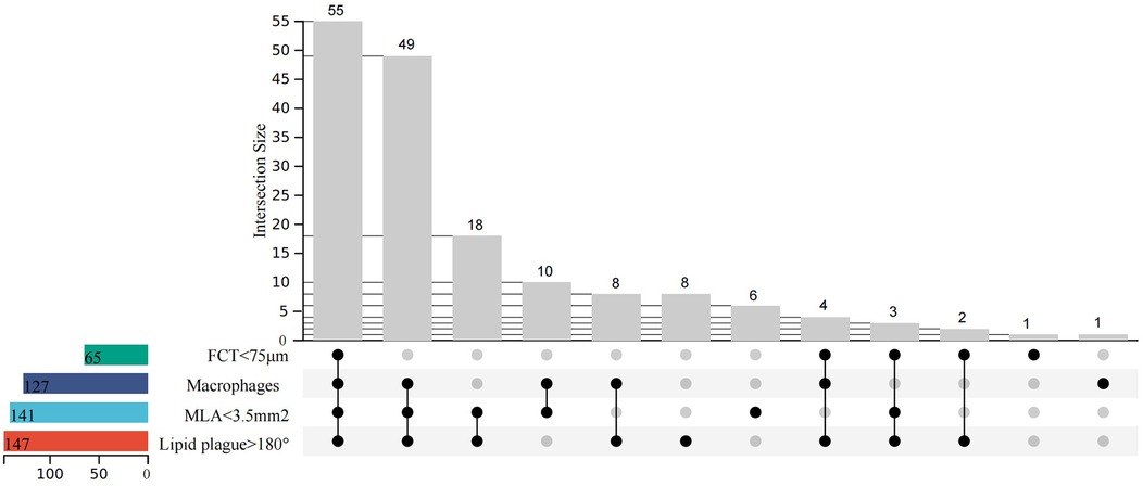 Bar chart with intersection sizes of four variables: FCT less than 75 micrometers, macrophages, MLA less than 3.5 square millimeters, and lipid plaque over 180 degrees. The chart shows values ranging from 55 to 1 based on combinations of these variables. A legend displays color-coded bars indicating counts.
