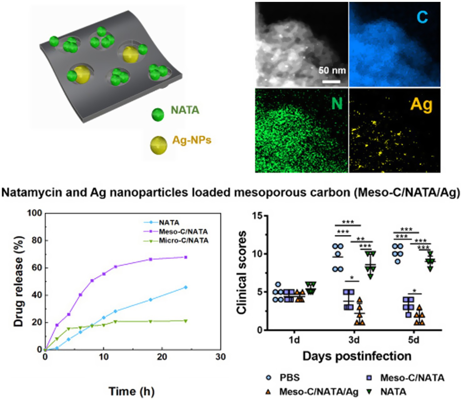 Illustration of natamycin (green spheres) and silver nanoparticles (yellow spheres) within mesoporous carbon. Four microscopy images show carbon, nitrogen, and silver elements. A graph depicts drug release percentages over 30 hours for NATA, Meso-C/NATA, and Micro-C/NATA. Another graph shows clinical scores across one, three, and five days post-infection for PBS, Meso-C/NATA, Meso-C/NATA/Ag, and NATA groups, with statistical significance indicated by asterisks.