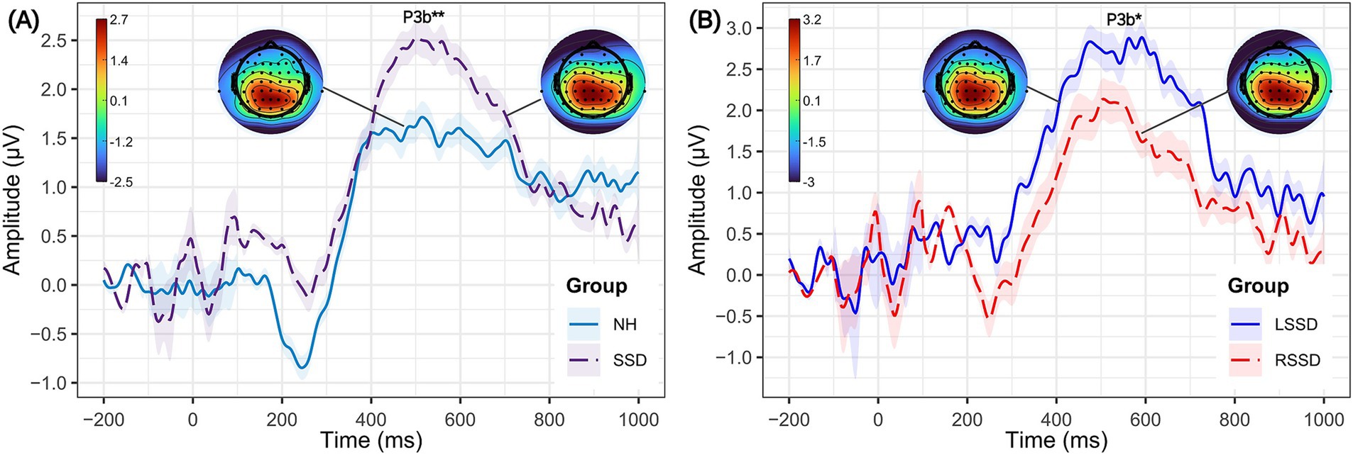 The graph displays two ERP waveforms (A and B), with amplitude (microvolts) plotted against time (milliseconds). Diagram A compares the response to a rare stimulus between NH and SSD groups, showing an increased P3b amplitude in the SSD group around 450 ms. Diagram B compares LSSD and RSSD groups, with LSSD exhibiting larger P3b amplitudes. Topographical maps illustrate the brain activity distribution for the P3b peak, color-coded from blue (low amplitude) to red (high amplitude).