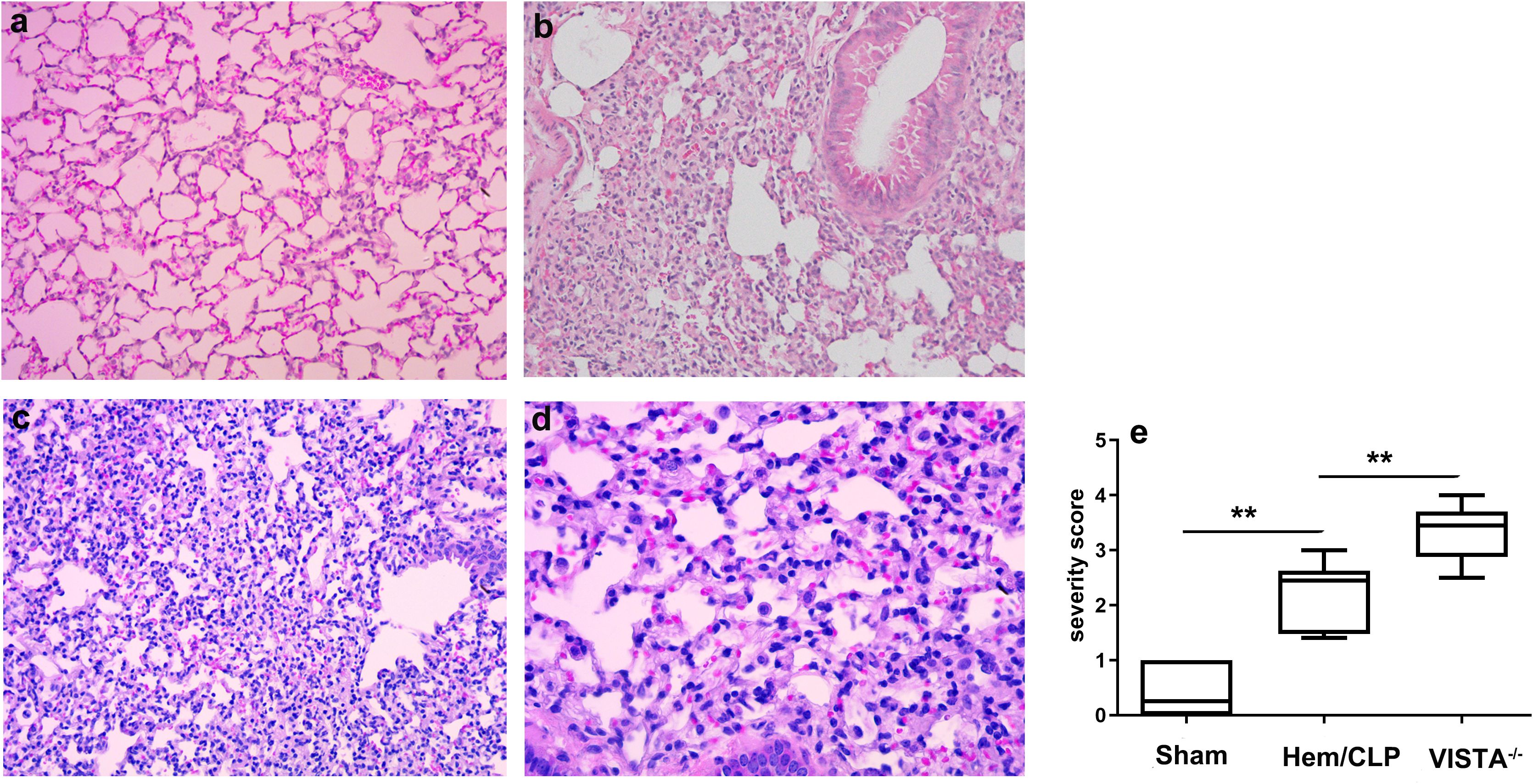 Histological images and a bar graph illustrate lung tissue samplesand severity scores. Panel a shows normal alveolar structure. Panel b displays moderate inflammation. Panels c and d exhibit severe inflammation with increased cellular infiltration. Panel e is a bar graph comparing severity scores across sham, Hem/CLP, and VISTA-/- groups, with higher scores in the latter two, indicating significant inflammation.