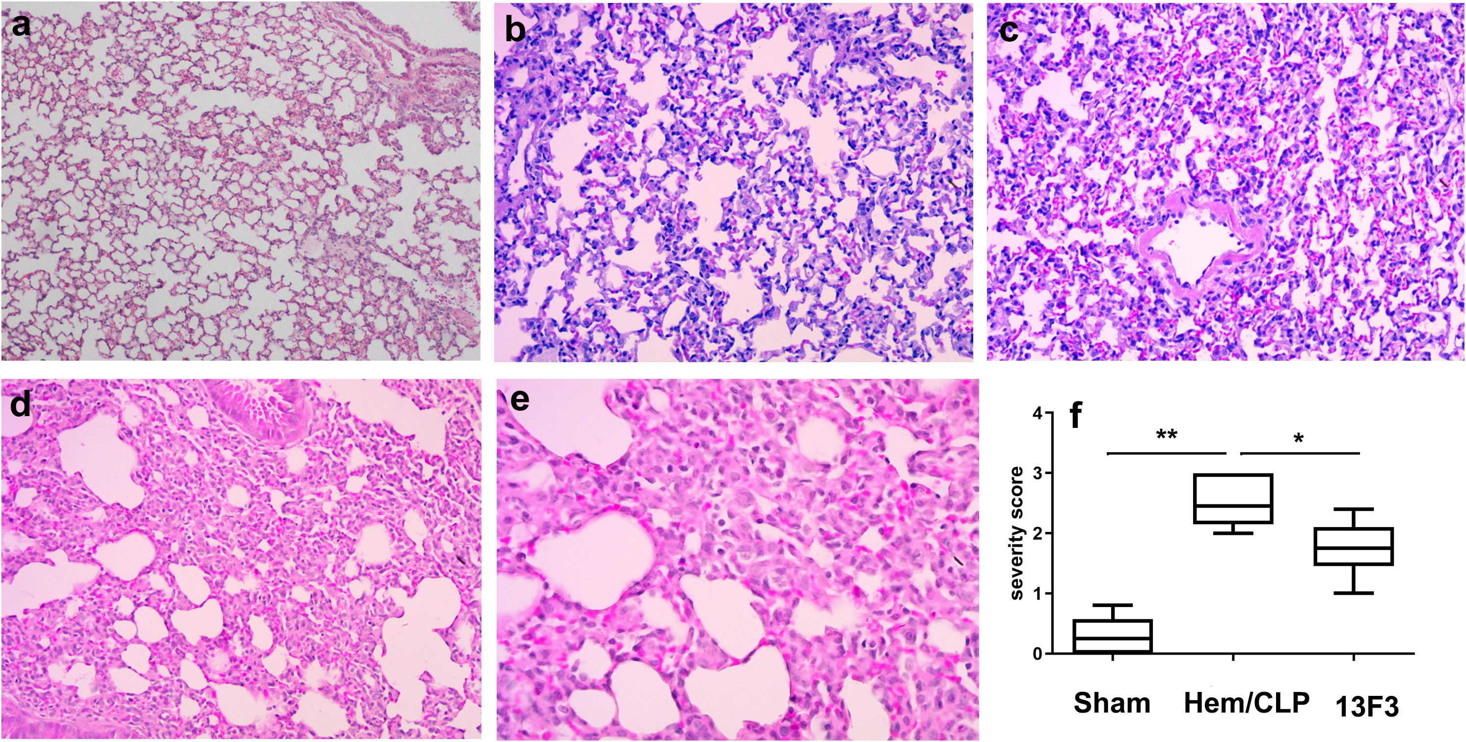 Lung tissue images are shown in panels a to e with increasinginflammation and damage. Panel f presents a box plot comparing severity scores of different treatments: Sham, Hem/CLP, and 13F3. The Sham group shows the lowest score, while Hem/CLP is highest. Statistical significance is indicated by asterisks.