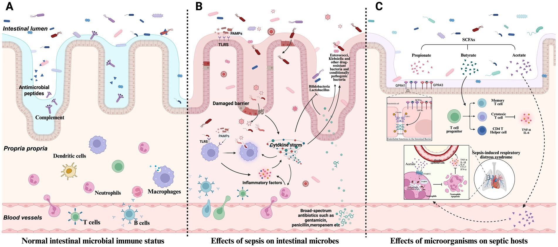 Illustration displaying three panels comparing normal intestinal microbial immune status, effects of sepsis on intestinal microbes, and effects of microorganisms on septic hosts. Panel A depicts normal intestinal function with antimicrobial peptides and immune cells. Panel B shows damage due to sepsis, including cytokine storms and barrier damage. Panel C illustrates the role of short-chain fatty acids and effects like sepsis-induced respiratory distress syndrome, highlighting pathways and cellular interactions. Each panel includes labeled components and interactions in the context of microbial and immune responses.