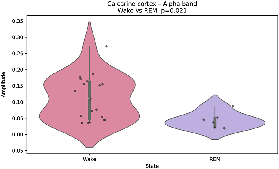 Violin plot comparing amplitude in the alpha band of the calcarine cortex during wakefulness and REM sleep. The wake state is shown in pink, with higher amplitude values, while REM is in purple with lower values. The p-value is 0.021, indicating a statistical difference.