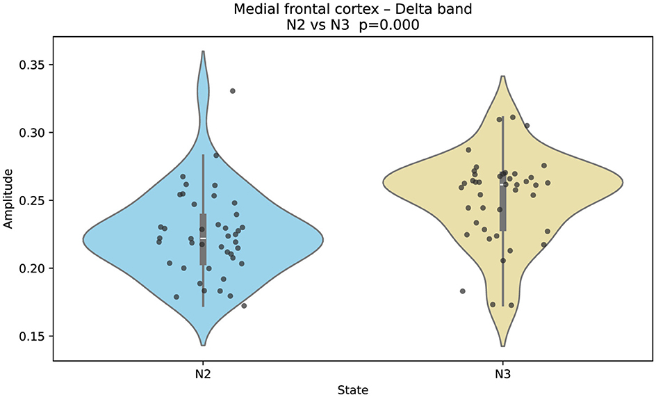Violin plot comparing amplitude of the delta band in the medial frontal cortex between states N2 and N3. N2 displays a wider distribution with a slightly higher range than N3. Both plots are centered around similar median values. Statistical significance is indicated with p = 0.000.