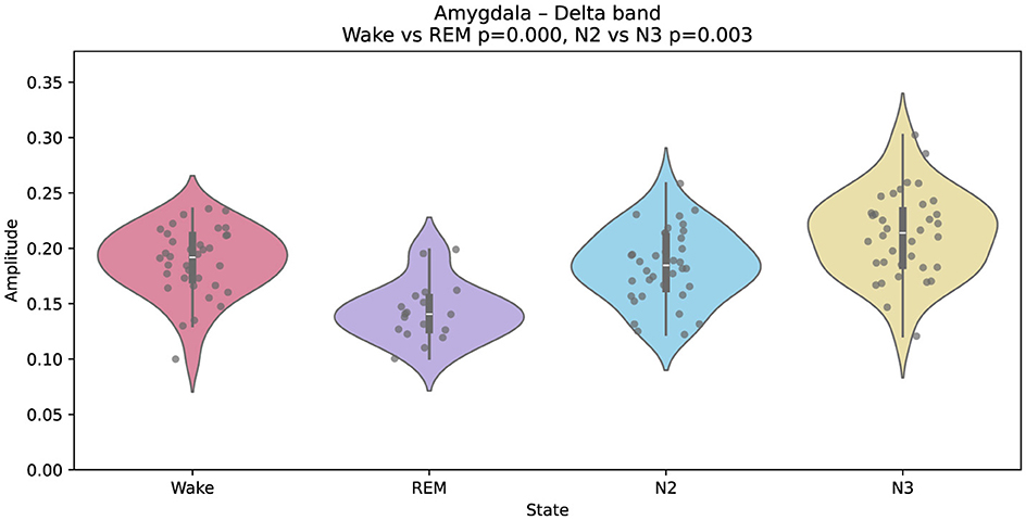 Violin plot depicting amplitude distributions of the delta band in the hippocampus across four states: Wake, REM, N2, and N3. Each plot shows a central line indicating the median and scatters dots representing data points. Statistical significance is noted between Wake vs. REM and N2 vs. N3 with respective p-values of 0.000 and 0.001.