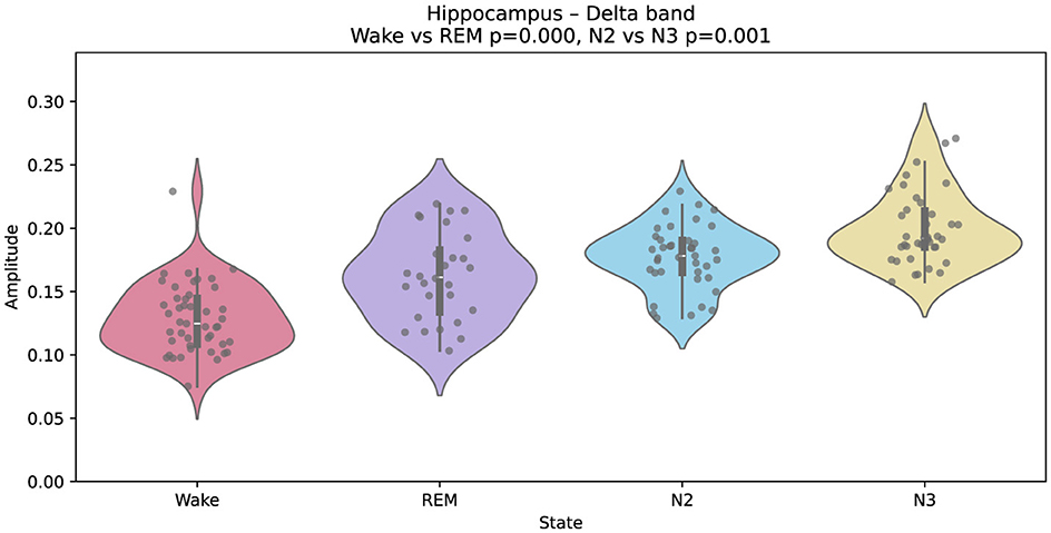 Violin plot showing the amplitude of the delta band in the amygdala across four states: Wake, REM, N2, and N3. Each state displays a distribution with individual data points. Significant differences are noted between Wake and REM (p=0.000), and N2 and N3 (p=0.003).
