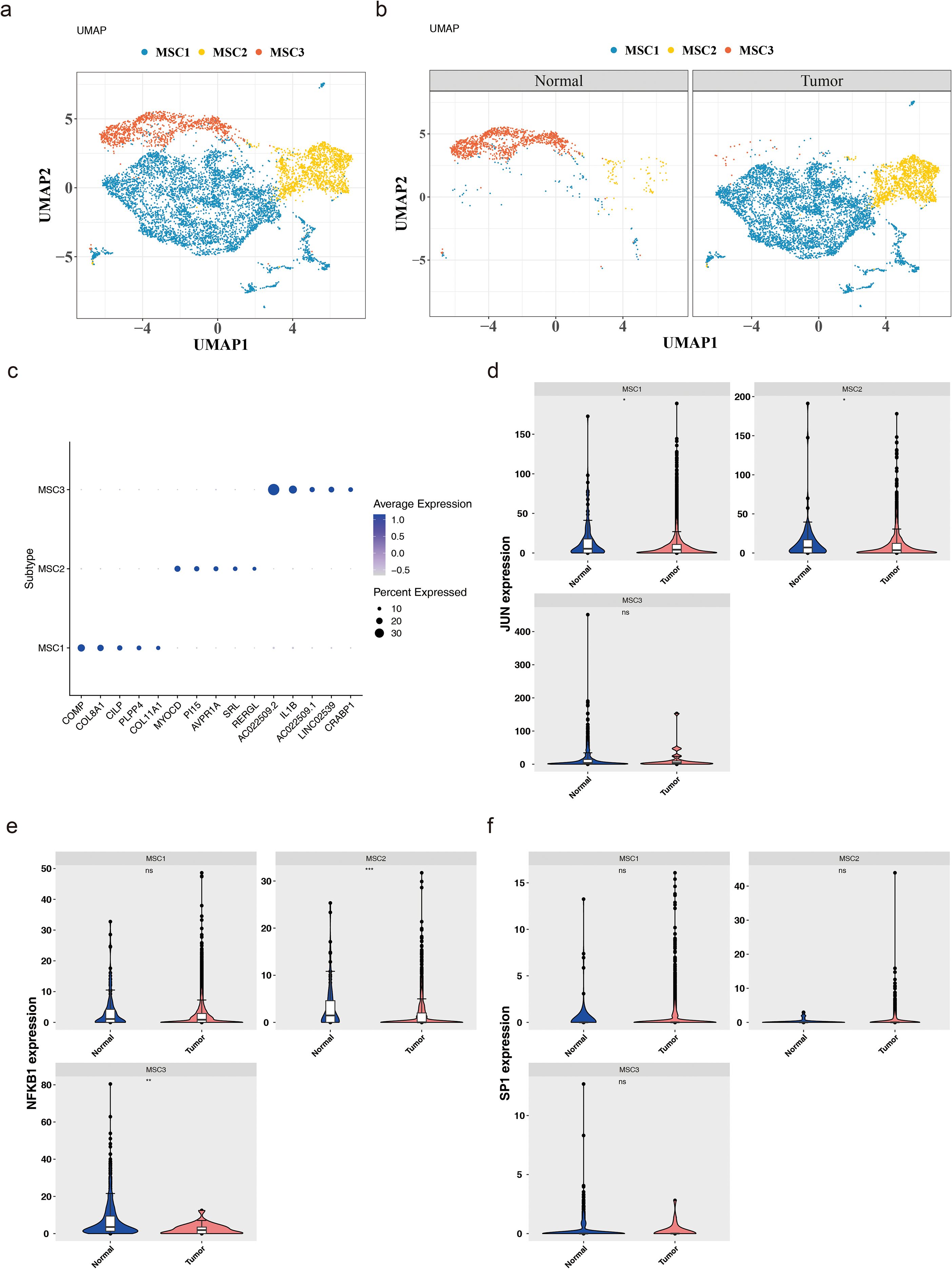Panel a shows a UMAP plot depicting three MSC subtypes: MSC1 in blue, MSC2 in yellow, MSC3 in red. Panel b presents UMAP plots comparing normal and tumor samples with the same subtype color coding. Panel c displays a dot plot of gene expression levels across MSC subtypes with blue indicating expression intensity and dot size reflecting the percentage expressed. Panel d-f feature violin plots comparing JUN, NFKB1, and SP1 gene expressions in normal versus tumor samples for each MSC subtype, highlighting variations in distribution and expression levels.