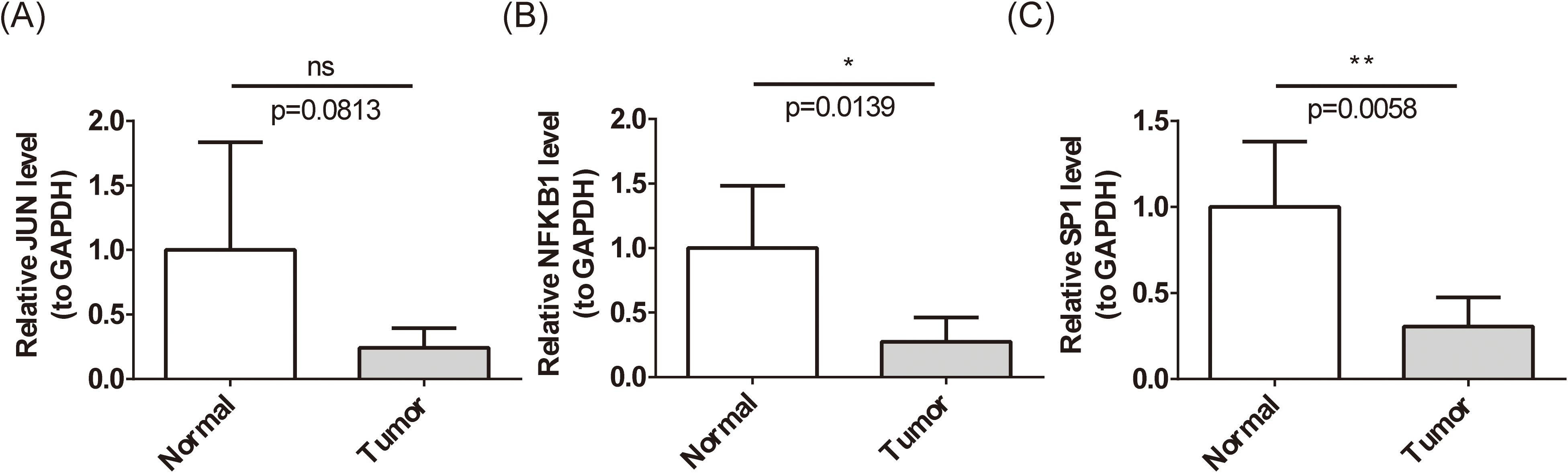 Bar graphs show the relative expression levels of JUN, NFKB1, and SP1 normalized to GAPDH in normal and tumor samples. Graph A (JUN) shows no significant difference (p=0.0813). Graph B (NFKB1) shows significant downregulation in tumors (p=0.0139). Graph C (SP1) shows significant downregulation in tumors (p=0.0058). Error bars indicate variability.