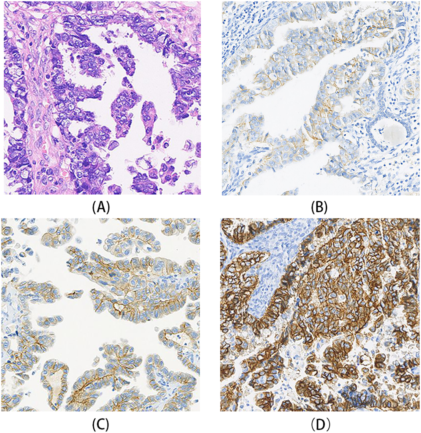 A series of four histological images labeled A, B, C, and D. Image A shows a purple-stained tissue section. Images B and C display light brown staining on cellular structures against a lighter background. Image D exhibits a dense brown staining pattern on the tissue.