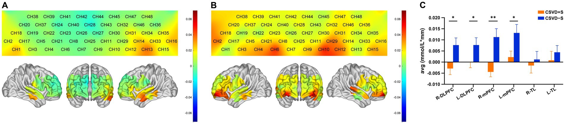 Panels A and B display brain images colored red to blue, indicating data ranges from positive to negative values. Each has corresponding grids with channel (CH) numbers. Panel C shows a bar graph comparing average values for CSVD+S and CSVD−S across different brain regions, with significant differences marked by asterisks.