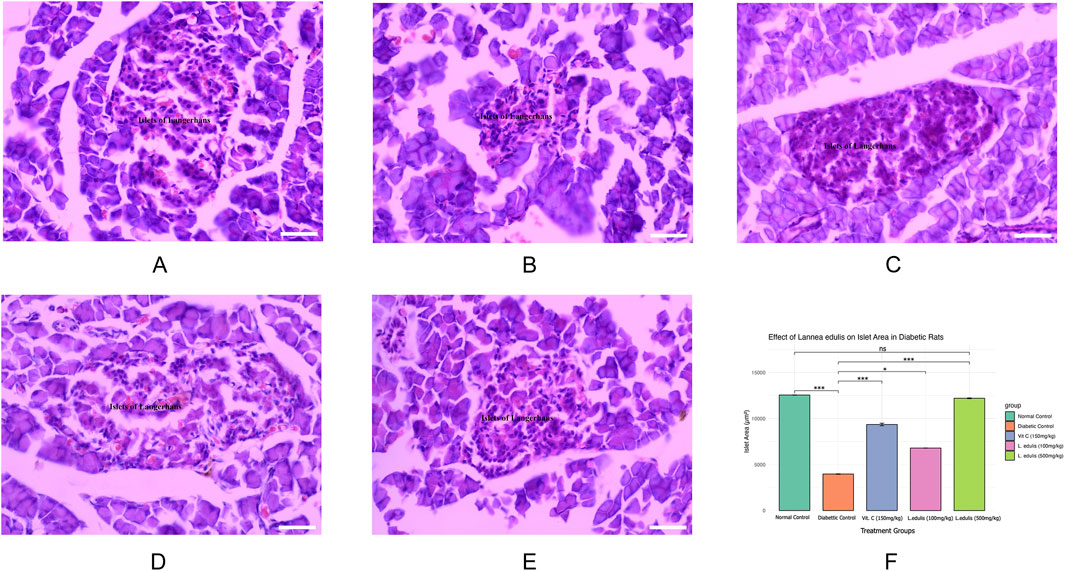 Panels A to E display histological images of pancreatic tissue, highlighting the islets of Langerhans stained in purple. Panel F presents a bar chart titled