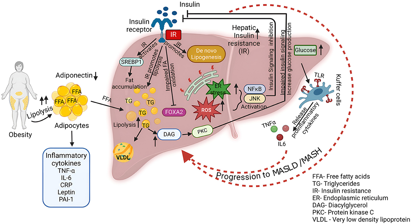 Diagram illustrating the progression of nonalcoholic fatty liver disease in obesity. Adipocytes release free fatty acids and inflammatory cytokines, contributing to insulin resistance and lipogenesis in the liver. Key components include insulin receptor activation, impaired fatty acid oxidation, and endoplasmic reticulum stress, leading to fat accumulation and activation of pathways such as NFκB and JNK. Kupffer cells release inflammatory cytokines, promoting disease progression to metabolic dysfunction-associated steatotic liver disease (MASLD) and metabolic dysfunction-associated steatohepatitis (MASH). Abbreviations are provided for main terms.