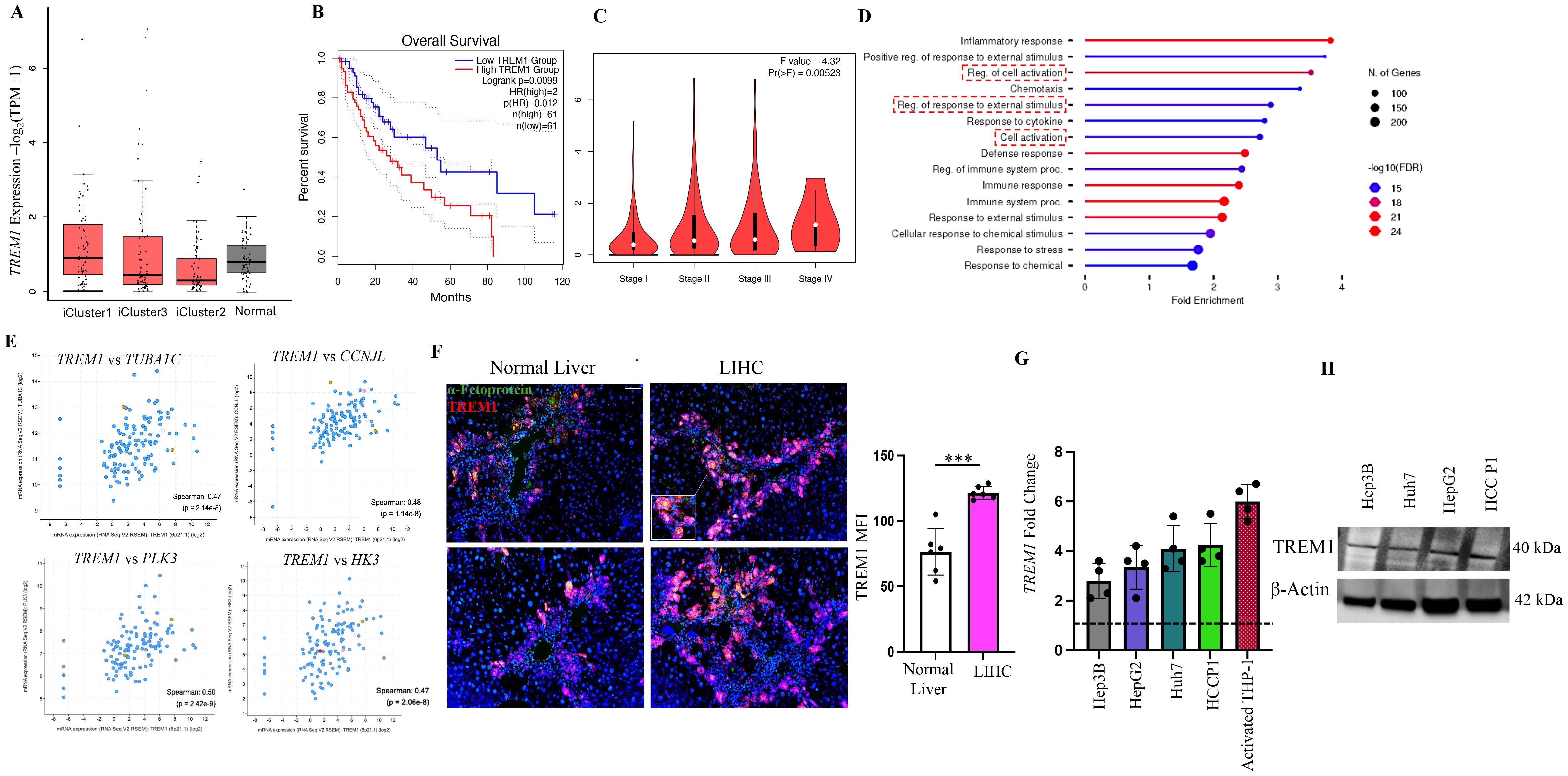 Graphs and charts related to TREM1 expression and liver cancer analysis. Panel A shows a box plot of TREM1 expression across different iClusters and normal samples. Panel B presents an overall survival curve comparing low and high TREM1 expression. Panel C displays a violin plot of TREM1 expression across cancer stages. Panel D features a bar chart of gene enrichment related to inflammatory responses. Panel E shows scatter plots correlating TREM1 with other genes. Panel F includes immunofluorescence images comparing normal liver and liver cancer (LIHC) tissues. Panel G depicts a bar chart of TREM1 fold change. Panel H contains a Western blot of TREM1 and β-Actin across various cell lines.