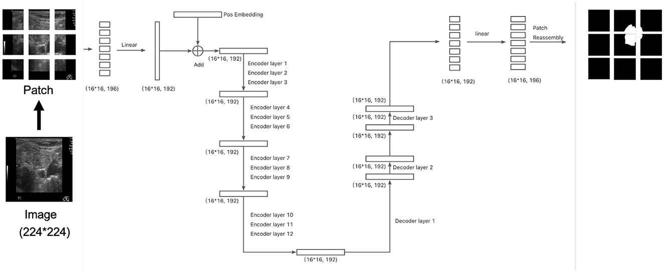Flowchart of an image processing model. The process starts with a 224x224 image, divided into patches. Each patch undergoes linear transformation, positional embedding, and is fed into encoder layers one to twelve, each having a 16x16x192 dimension. Subsequent decoder layers further process, culminating in a linear transformation for patch reassembly. The output shows segmented patches reassembled into a final image