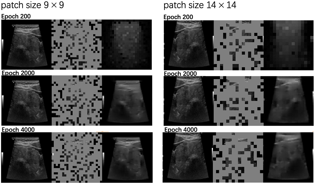 Comparison of image reconstructions at different epochs with patch sizes. The left column shows a 9x9 patch size and the right column a 14x14 patch size. Each set includes ultrasound images at epochs 200, 2000, and 4000. Images show varying levels of noise and reconstruction detail based on patch size and epochs.
