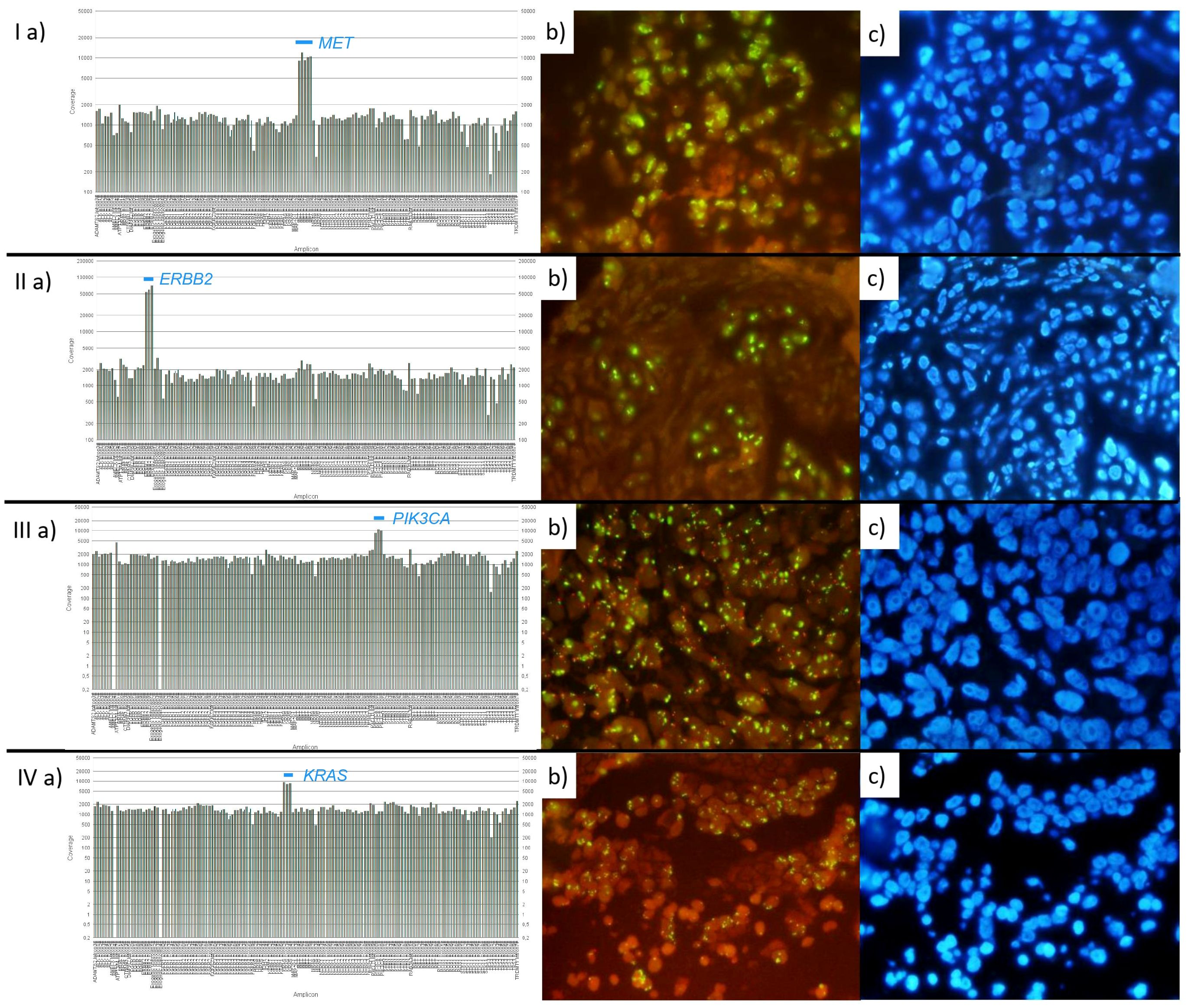 Panel of images showing experimental data of genetic expressions and cell visualizations. Row I displays MET gene expression with associated orange and blue stained cells. Row II presents ERBB2 gene analysis with similar cell stains. Row III features PIK3CA gene data with corresponding cell images. Row IV depicts KRAS gene information alongside stained cells. Each row includes a bar graph and two fluorescently stained cell images labeled a, b, and c.