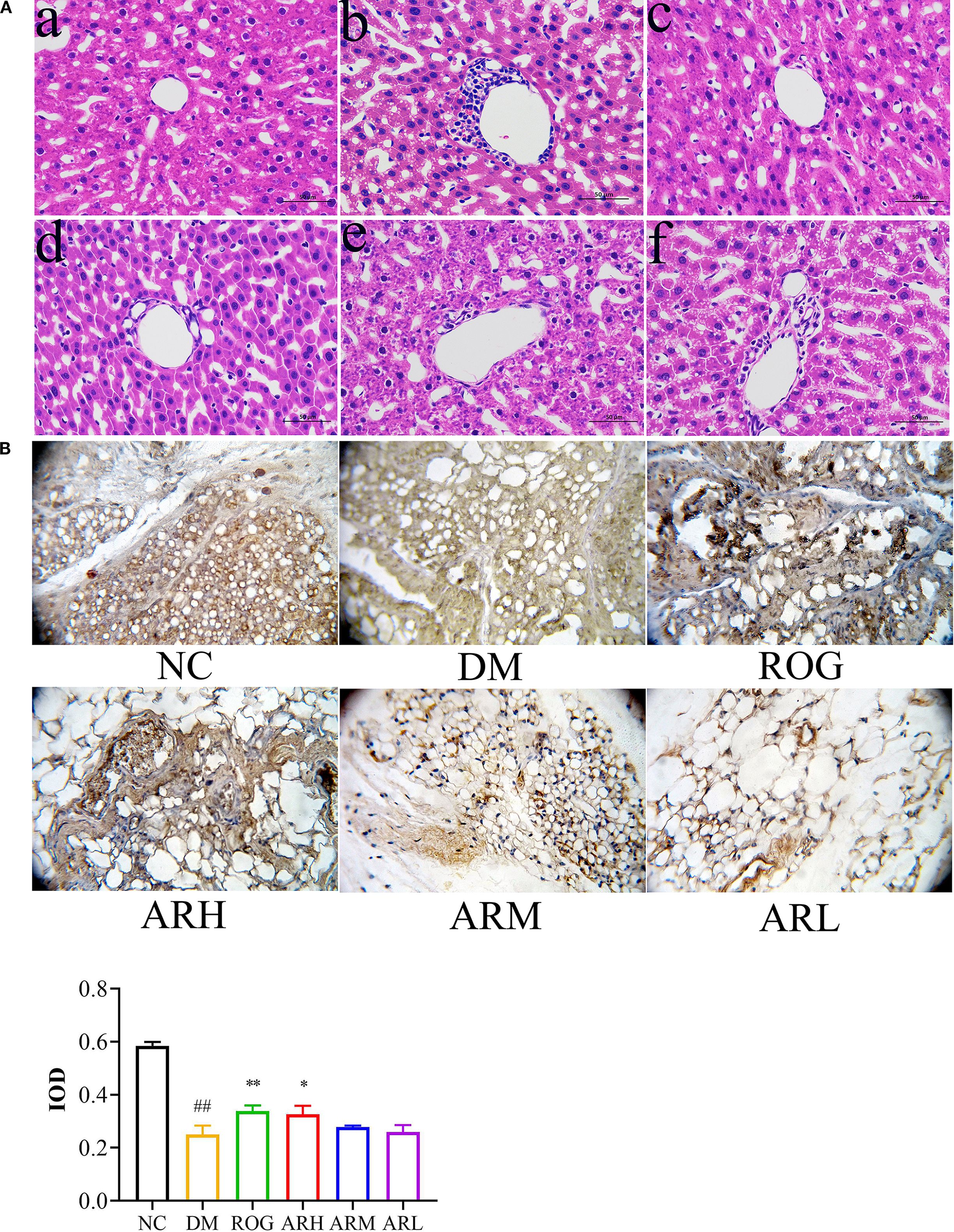 Panel A shows microscopic images of liver tissues stained with hematoxylin and eosin, labeled a to f, displaying varying degrees of cellular structure. Panel B contains images of adipose tissue sections stained with different markers corresponding to groups labeled NC, DM, ROG, ARH, ARM, and ARL. The bar graph below illustrates the Integrated Optical Density (IOD) values for each group, with NC showing the highest and DM showing a significant decrease. Some groups are marked with asterisks and hashtags indicating statistical significance.