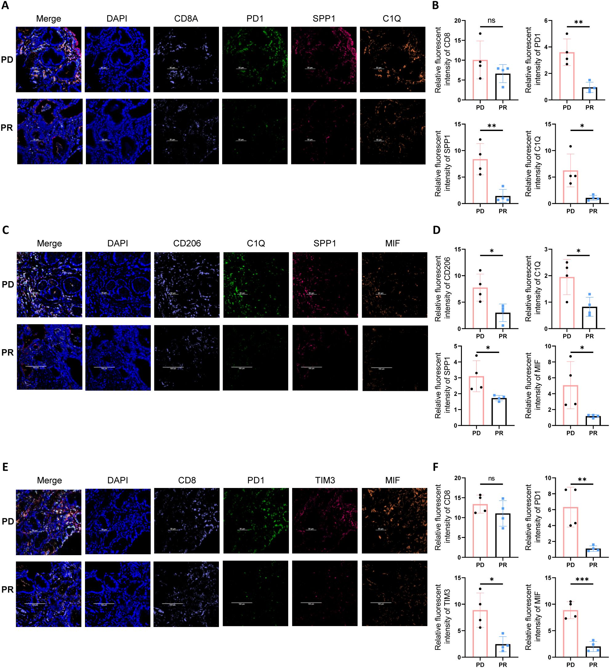 Immunofluorescence microscopy images and bar graphs are shown in panels labeled A-F. Panels A, C, and E display merged and individual stainings of tissue samples for PD and PR conditions. Fluorescent markers include DAPI, CD8A, PD1, SPP1, C1Q, CD206, TIM3, and MIF. Panels B, D, and F contain bar graphs comparing the relative fluorescent intensity of these markers between PD and PR. Statistically significant differences are indicated by asterisks.