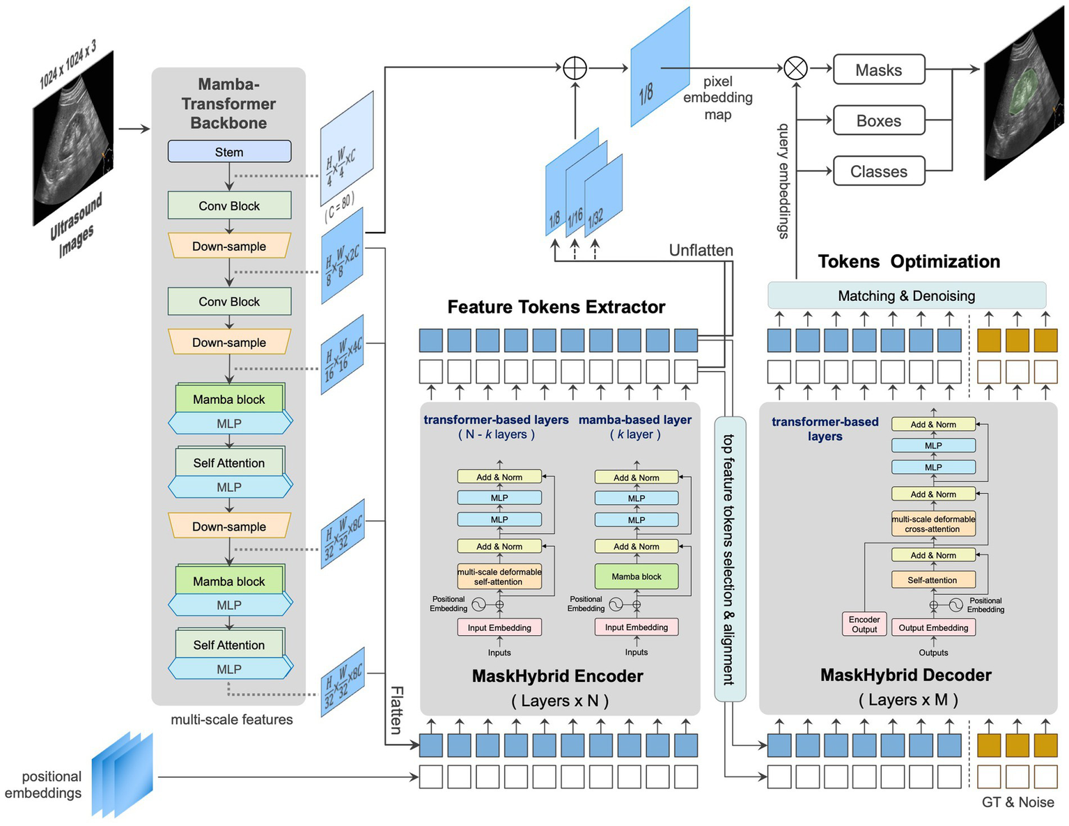 Flowchart illustrating a machine learning model for ultrasound image processing. It outlines steps from input images through a Mamba-Transformer Backbone, which includes convolution blocks and Mamba blocks, to feature extraction and token optimization. Output includes masks, boxes, and classes. The system involves positional embeddings, transformer-based layers, and token matching and denoising processes.