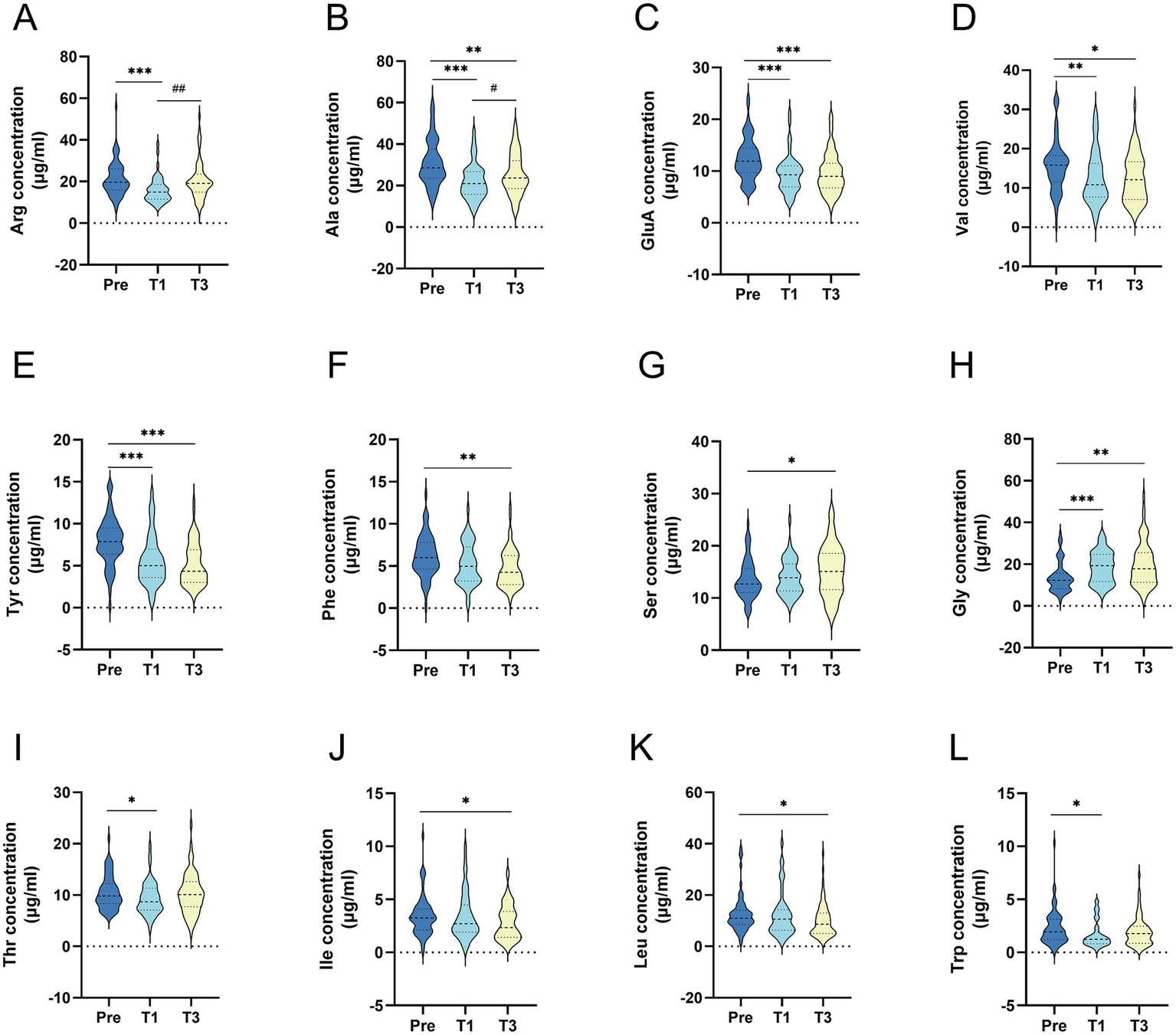 Twelve violin plots labeled A to L compare amino acid concentrations at three time points: Pre, T1, and T3. Each plot shows differences in concentration for specific amino acids: Arg (A), Ala (B), GluA (C), Val (D), Tyr (E), Phe (F), Ser (G), Gly (H), Thr (I), Ile (J), Leu (K), and Trp (L). Statistical significance is indicated by asterisks above the plots.