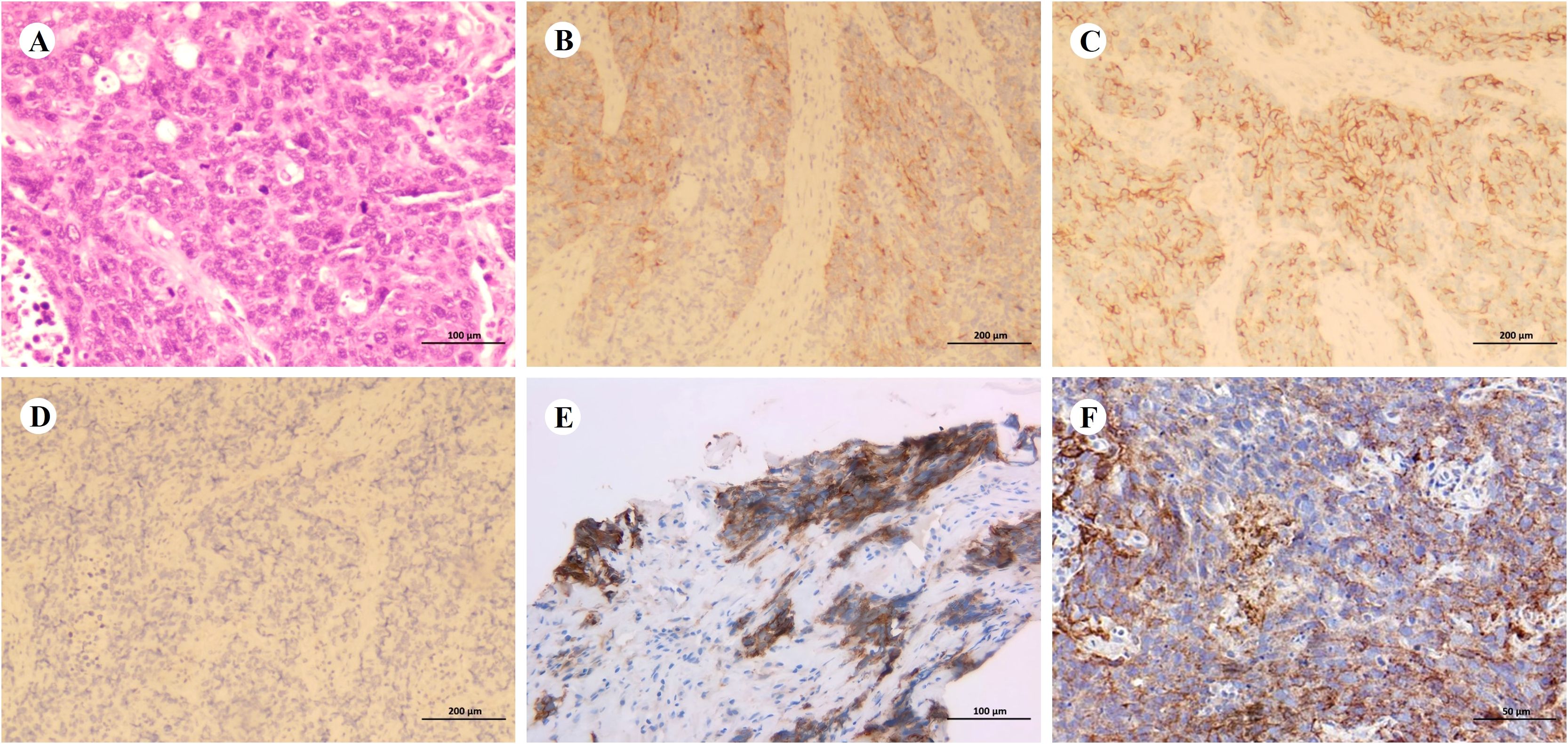 Microscopic images labeled A to F showing tissue samples stained with different techniques. A: pink with cellular details. B and C: tan with brownish cellular patterns. D: uniform tan background. E: dark brown and light blue textures. F: intricate mix of brown and blue structures. Scale bars indicate magnification levels.