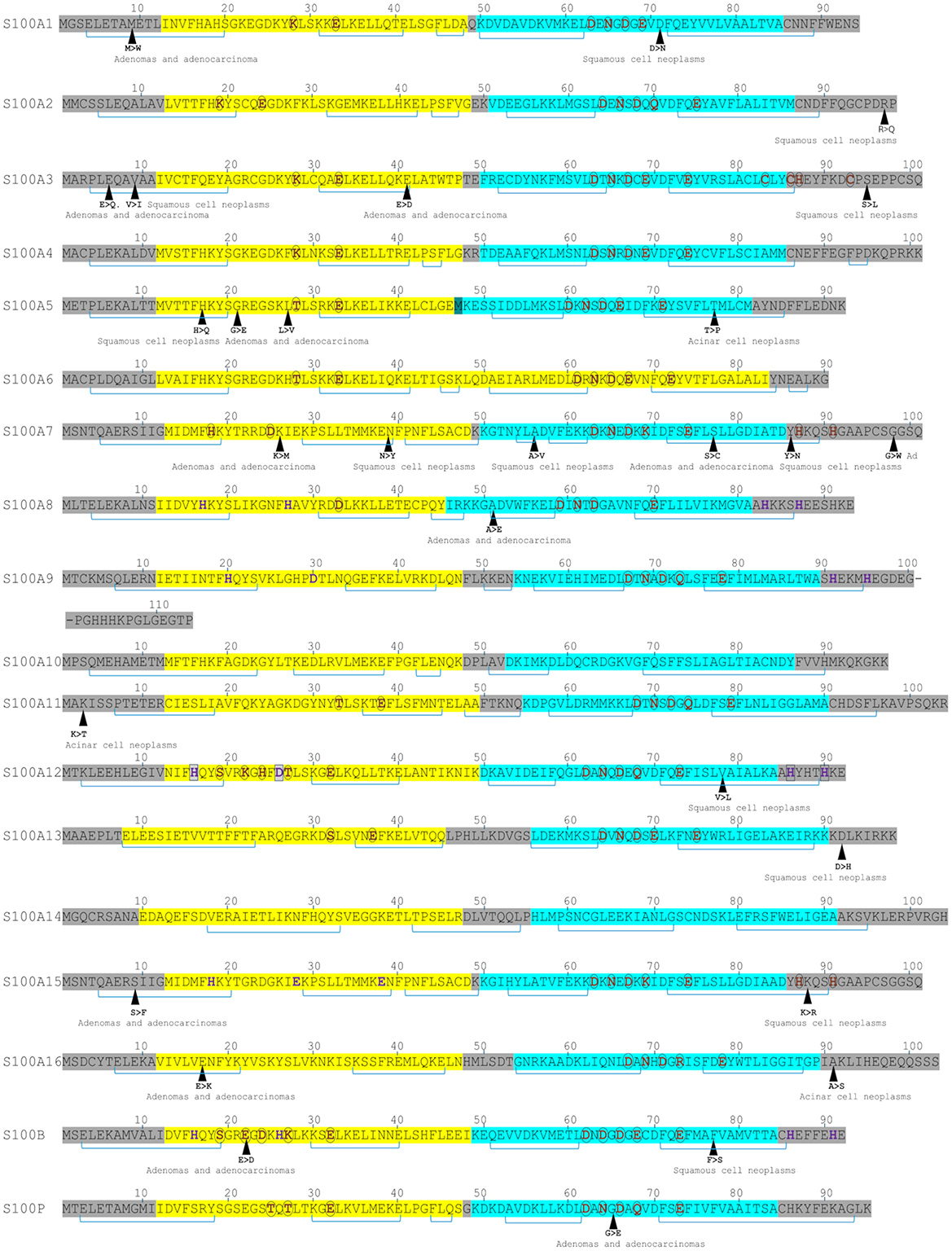 Sequence alignment chart showing amino acid sequences of S100A1 to S100A16, S100B, and S100P. Sections are highlighted in yellow and blue (EF-hand motif), Ca, Cu, and Zn binding amino acids, with specific regions marked by arrows indicating mutations associated with neoplasms such as adenoma, adenocarcinoma, and squamous cell neoplasms. Number scales at the top indicate sequence lengths.