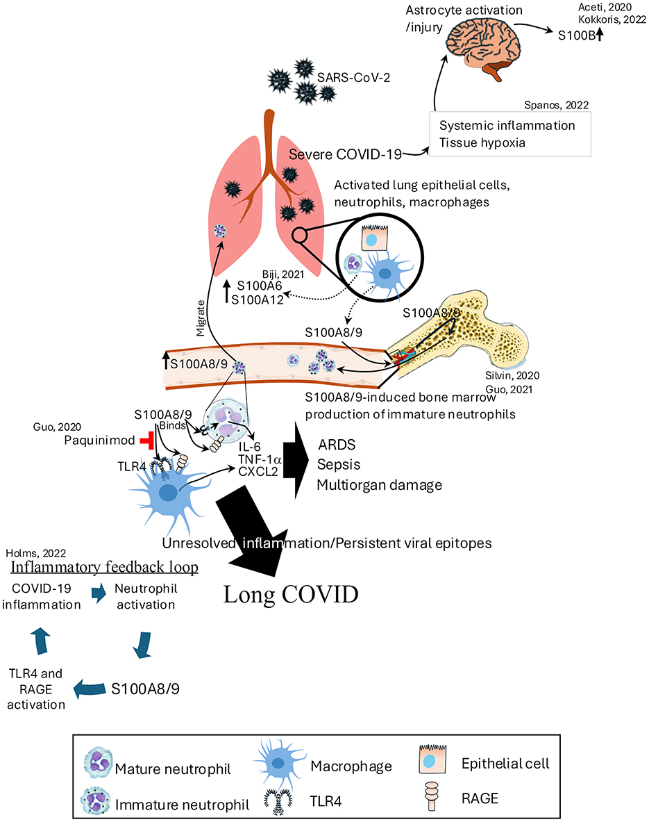 Diagram illustrating the role of S100 proteins in COVID-19 and long COVID. The virus-infected lungs, activated epithelial cells, neutrophils, and macrophages release S100 proteins. This triggers bone marrow to produce immature neutrophils, activates macrophages, and causes a cytokine storm leading to conditions like ARDS, sepsis, and multiorgan damage. The unresolved inflammation creates a feedback loop, resulting in long COVID. Indications show connections to systemic inflammation and tissue hypoxia, affecting the brain. Key elements include TLR4 pathways and RAGE activation.