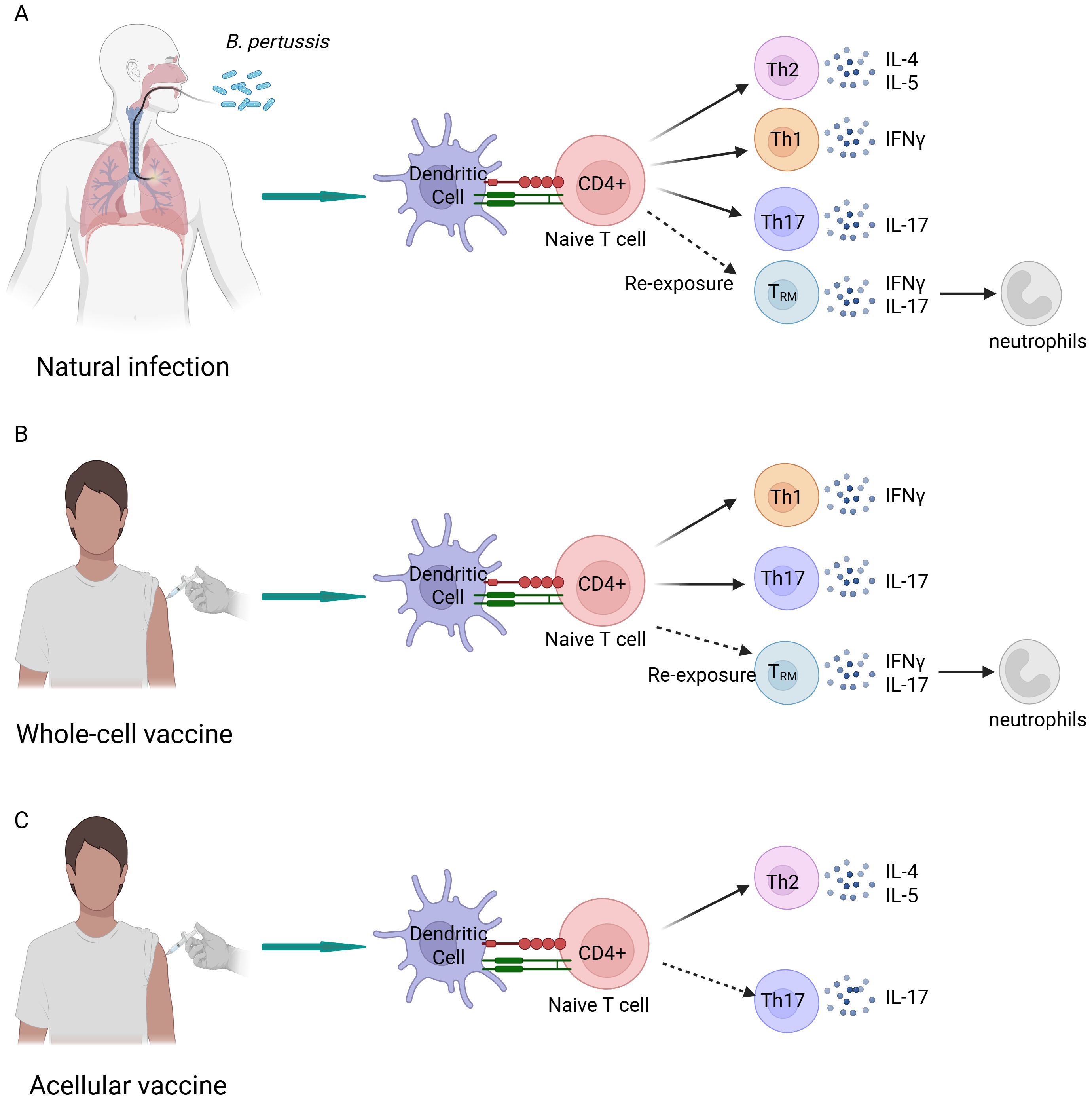 Diagram comparing immune responses to Bordetella pertussis infection, whole-cell vaccine, and acellular vaccine. Panel A shows natural infection activating CD4+ T cells, inducing Th1, Th2, Th17, and memory T cells, producing interleukins and interferon for immune response. Panel B illustrates the whole-cell vaccine activating similar T cell responses. Panel C shows the acellular vaccine activating CD4+ T cells and mostly Th2 and Th17 responses.