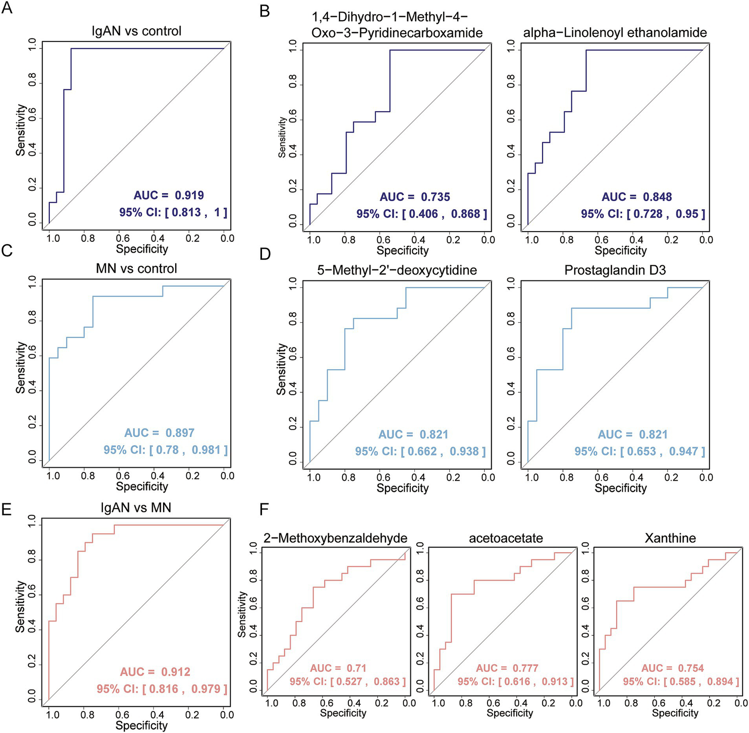 Six ROC curve graphs illustrate the diagnostic performance of various biomarkers. A shows IgAN versus control with AUC 0.919. B shows two graphs for 1,4-Dihydro-1-Methyl-4-Oxo-3-Pyridinecarboxamide and alpha-Linolenoyl ethanolamide with AUCs 0.735 and 0.848, respectively. C shows MN versus control with AUC 0.897. D shows 5-Methyl-2’-deoxycytidine and Prostaglandin D3 with AUC 0.821 each. E shows IgAN versus MN with AUC 0.912. F shows three graphs for 2-Methoxybenzaldehyde, acetoacetate, and Xanthine with AUCs 0.71, 0.777, and 0.754, respectively. Each graph includes 95% confidence intervals.