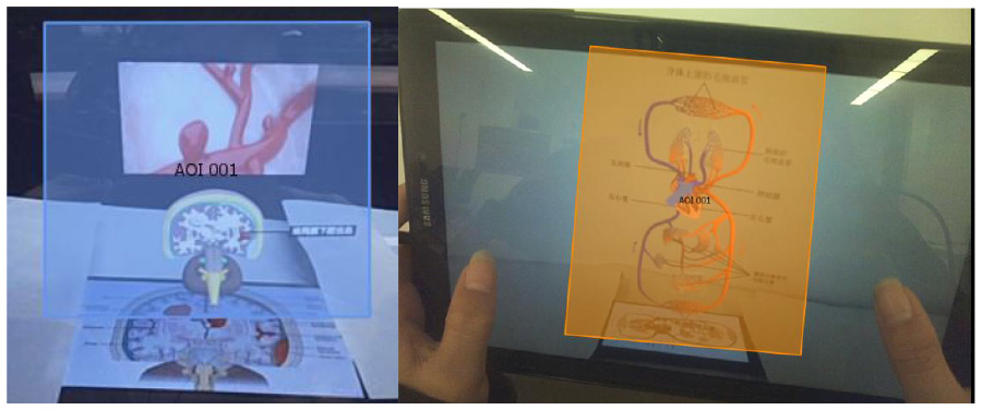 Digital screen showing two augmented reality applications. The left side features a brain scan with highlighted sections. The right side displays anatomical drawings with AR overlays. Hands hold the device.
