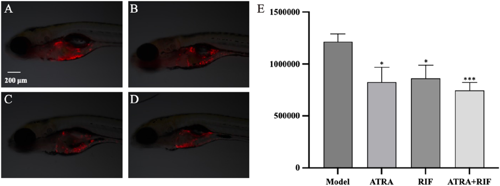 Four microscopy images labeled A, B, C, and D show zebrafish with red fluorescence, possibly indicating infection. A bar chart labeled E compares groups: Model, ATRA, RIF, and ATRA+RIF. The Model group shows highest measurement; ATRA and RIF are lower; ATRA+RIF is significantly lower, marked by three asterisks. Scale bar in A indicates 200 micrometers.