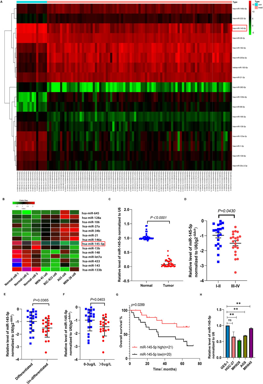 A series of graphs and charts depicting miRNA expression data. Panel A shows a heatmap of miRNA expression across different samples, highlighting hsa-miR-145-5p. Panel B presents a color key for miRNA expression levels. Panels C to F display scatter plots comparing miR-145-5p levels between normal and tumor samples, differentiated and undifferentiated samples, stages I-II and III-IV tumor samples, and based on miR-145-5p concentration levels. Panel G features a Kaplan-Meier survival curve comparing high and low miR-145-5p expression. Panel H is a bar graph comparing relative miR-145-5p levels across different cell lines.