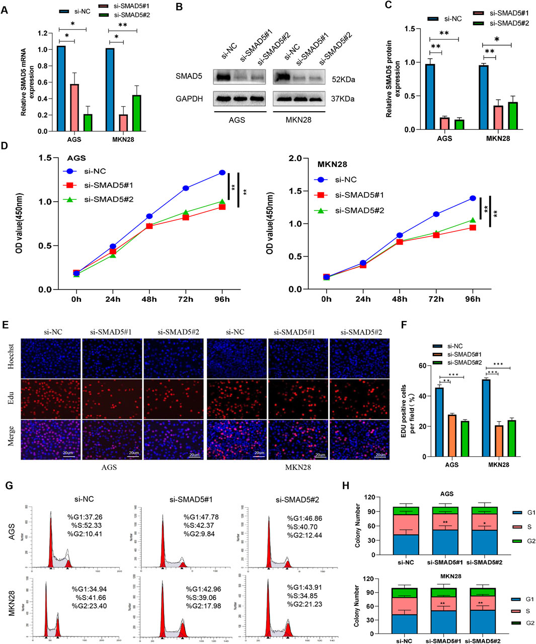 Graphical panels display a study on the effects of SMAD5 knockdown in AGS and MKN28 cells. A: Bar chart shows mRNA expression of SMAD5; si-SMAD5#1 and #2 reduce expression compared to control. B: Western blots indicate protein expression of SMAD5 and GAPDH. C: Bar chart reflects decreased SMAD5 protein in knockdown groups. D: Line graphs illustrate reduced cell proliferation over time in knockdown cells. E: Fluorescence images reveal fewer EdU-positive cells after SMAD5 knockdown. F: Bar chart quantifies EdU-positive cells. G: Histograms show cell cycle distribution change after knockdown. H: Stacked bar charts depict reduced colony numbers and changes in cell cycle phases post-knockdown.