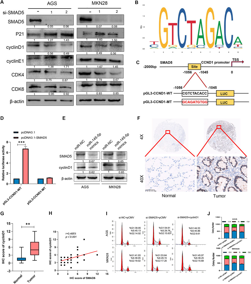 Panel of images depicting a scientific study on SMAD5, cyclinD1, and related proteins in gastric cancer cells. A: Western blot data show protein levels of SMAD5, P21, cyclinD1, cyclinE1, CDK4, CDK6, and β-actin in AGS and MKN28 cell lines treated with si-SMAD5.B: Sequence logo depicting nucleotide binding sites for CCND1 promoter.C: Diagram illustrating the SMAD5 binding site on the CCND1 promoter and constructs for luciferase assays.D: Bar graph showing relative luciferase activity between pcDNA3.1 and pcDNA3.1-SMAD5 groups.E: Western blot analysis of SMAD5 and cyclinD1 expression with miR-145-5p mimics in AGS and MKN28 cells.F: Immunohistochemical staining images comparing normal and tumor tissues at 4X and 40X magnifications.G: Box plot of immunohistochemistry (IHC) scores of cyclinD1 in normal and tumor tissues.H: Scatter plot correlating IHC score of cyclinD1 with SMAD5.I: Histogram flow cytometry data showing cell cycle distribution in AGS and MKN28 cells under different treatments.J: Bar charts of copy number variations in AGS and MKN28 cells across treatments.