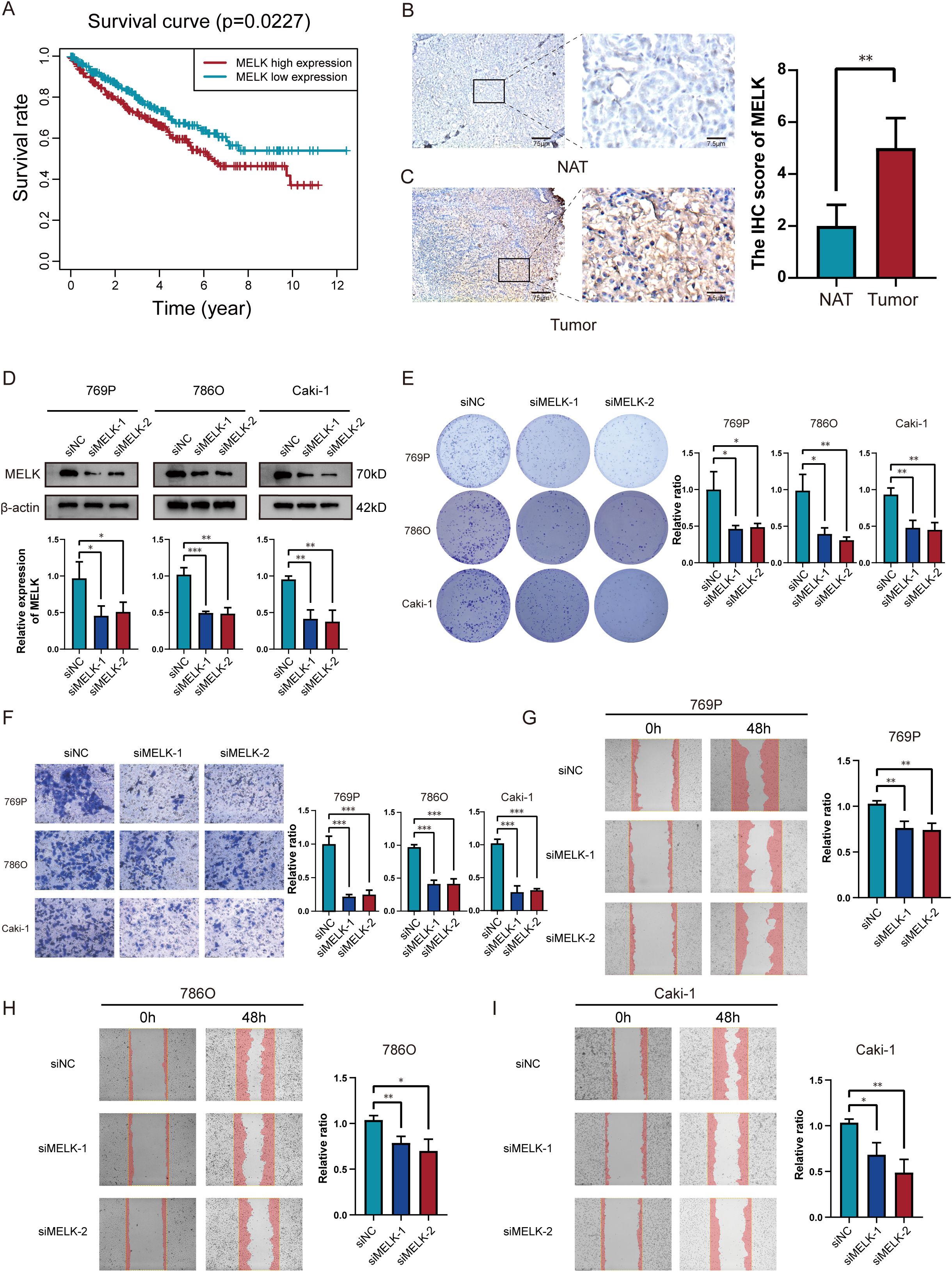 Composite image with multiple panels: A) Kaplan-Meier survival curve shows significantly lower survival for high MELK expression (p=0.0227). B) Immunohistochemistry (IHC) score comparison between normal adjacent tissue (NAT) and tumor, displaying higher MELK levels in tumor tissues, supported by a bar graph. C) Enlarged IHC images of NAT and tumor tissue, with tumor showing stronger MELK staining. D) Western blot images demonstrating MELK expression levels in 769P, 786O, and Caki-1 cells with siRNA treatments and corresponding bar graph for relative expression. E) Colony formation assay images for cell lines treated with siRNAs and respective bar graph showing decreased colony formation. F) Invasion assay images showing reduced cell invasion upon siRNA treatment, quantitatively represented in a bar graph. G-I) Scratch wound healing assay images at 0 and 48 hours for 769P, 786O, and Caki-1 cells, with corresponding bar graphs showing slower wound closure with MELK knockdown.