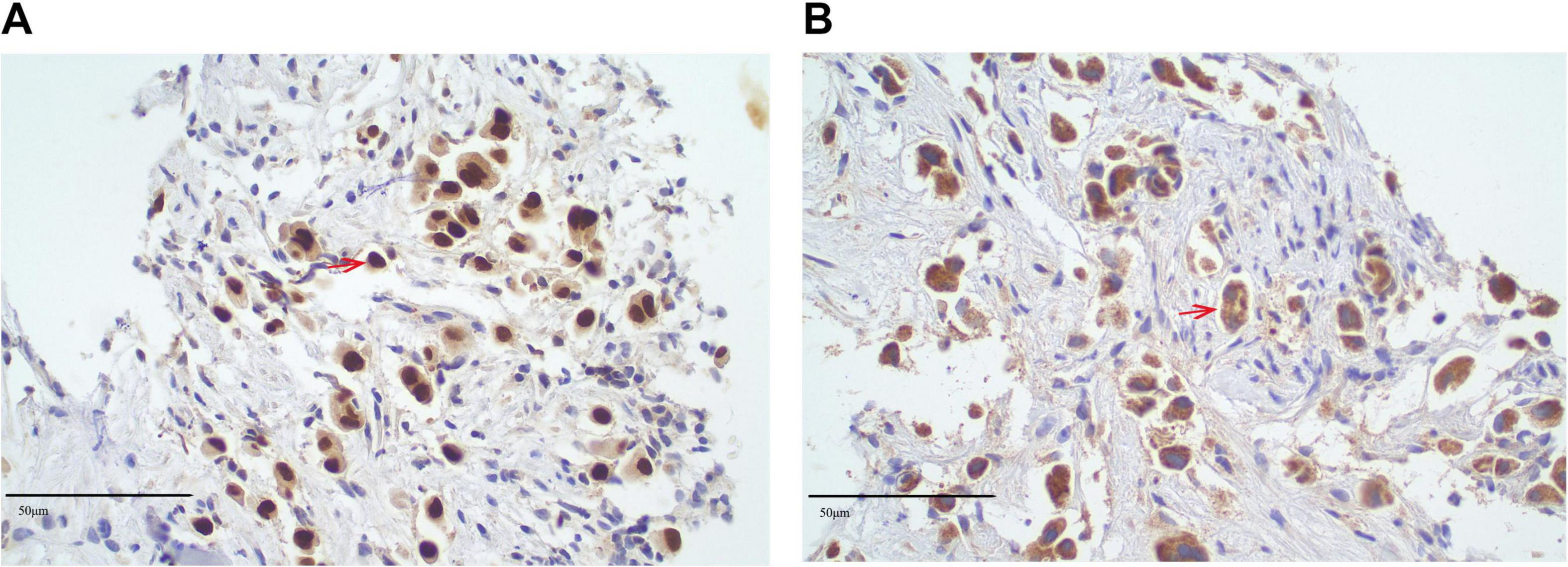 Microscopic images labeled A and B show stained tissue samples. Both depict clusters of cells with brown nuclei and blue-stained cytoplasm. Red arrows point to specific cells. The scale bars measure 50 micrometers.