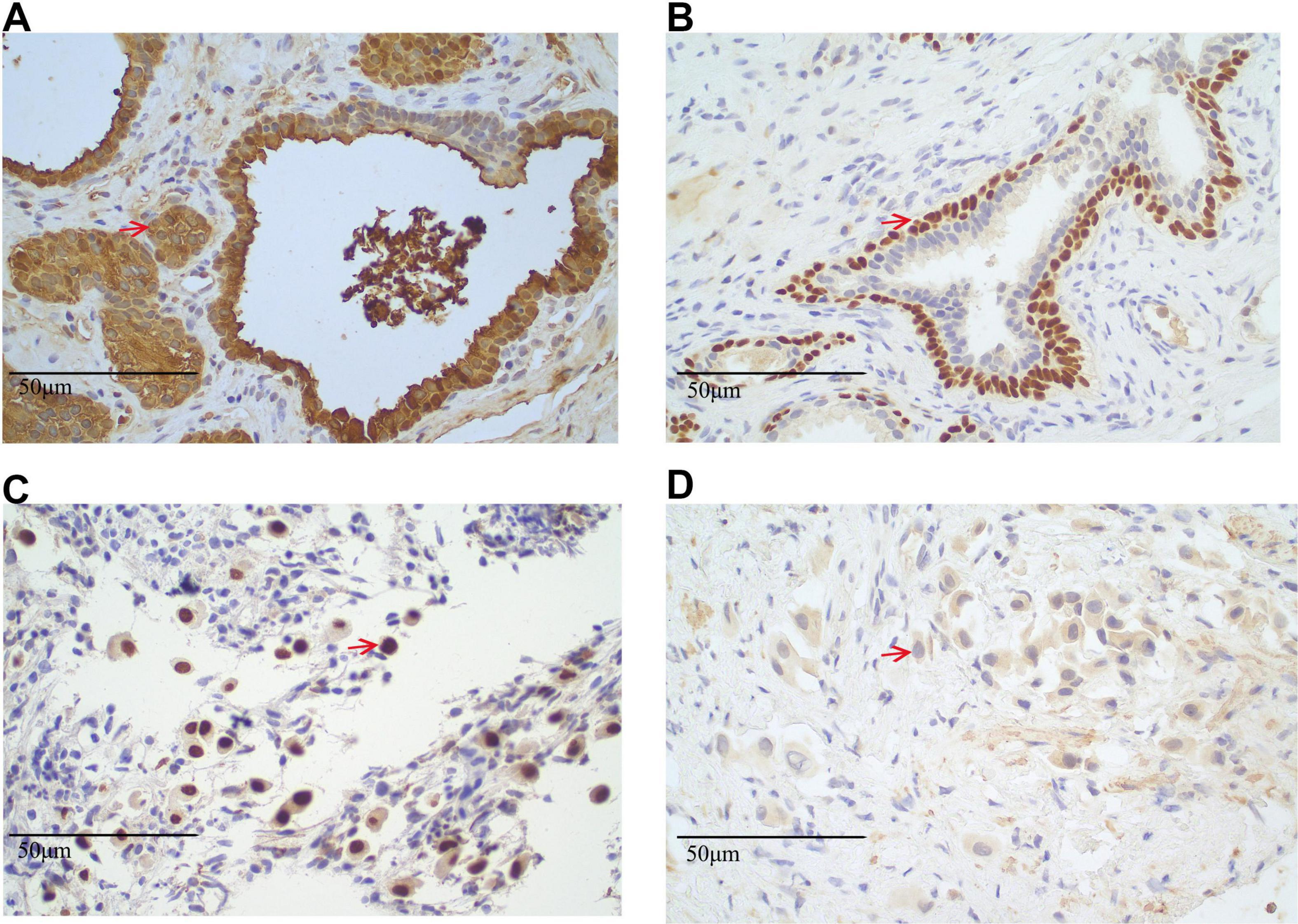Histological images labeled A, B, C, and D show tissue sections stained to highlight specific cellular components. Each section features a scale bar indicating 50 micrometers for scale. Darkly stained areas, highlighted by red arrows, indicate regions of interest within the tissue. Sections A and B show distinct structures with densely packed cells, while sections C and D appear to have more loosely arranged cells. The variations in staining intensity and cell arrangement suggest differences in cellular composition or activity across the samples.