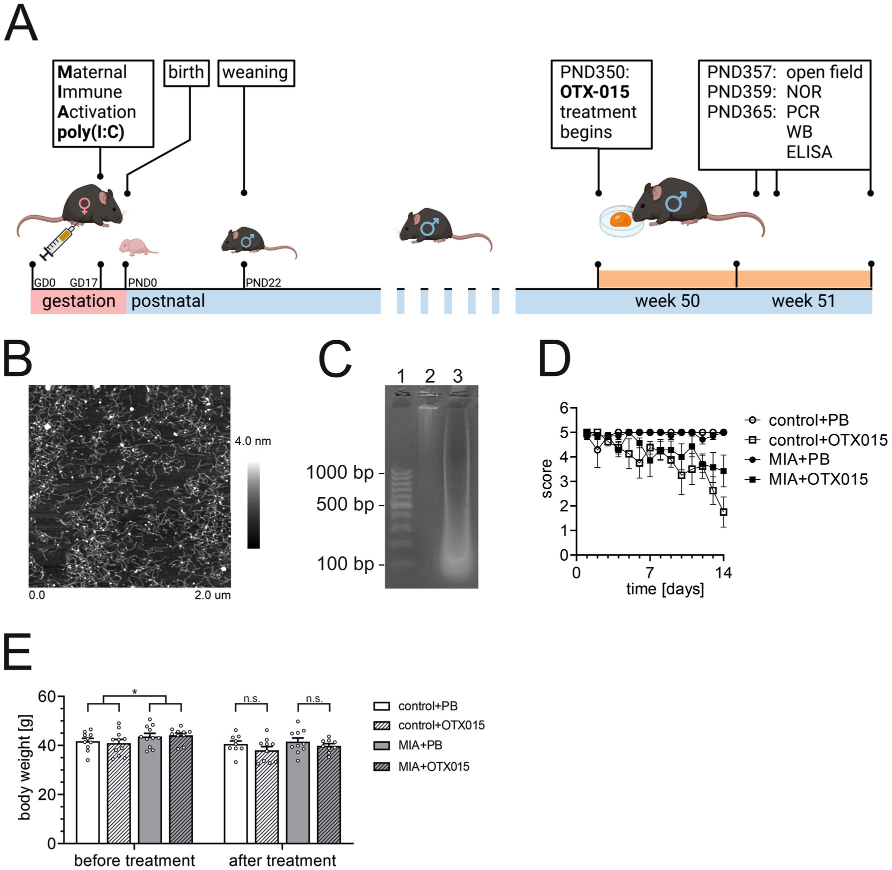 Illustrations and graphs depicting a scientific study on maternal immune activation and treatment effects on mice. Panel A showcases a timeline of gestation and postnatal development, highlighting treatment intervals and assessments. Panel B shows an electron micrograph image with a scale bar. Panel C displays a gel electrophoresis result with marker bands labeled in base pairs. Panel D is a line graph showing scores over time for different treatment groups, while Panel E is a bar graph comparing body weights before and after treatment across groups.