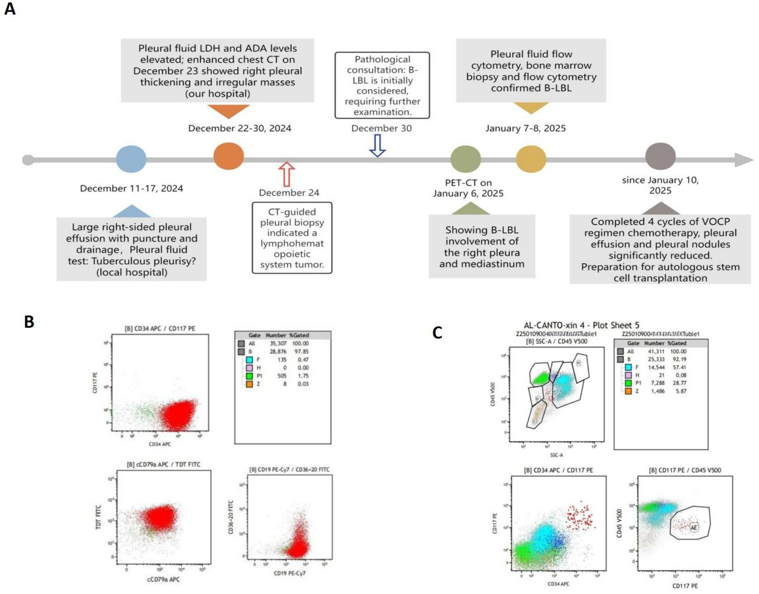 A timeline describes a medical case from December 2024 to January 2025, detailing pleural effusion diagnosis and treatment progression, including CT-guided biopsy and chemotherapy cycles leading to stem cell transplantation preparation. Two plots illustrate flow cytometry data of cell markers CD34, CD117, CD79a, TdT, and CD19, highlighting cellular distributions.