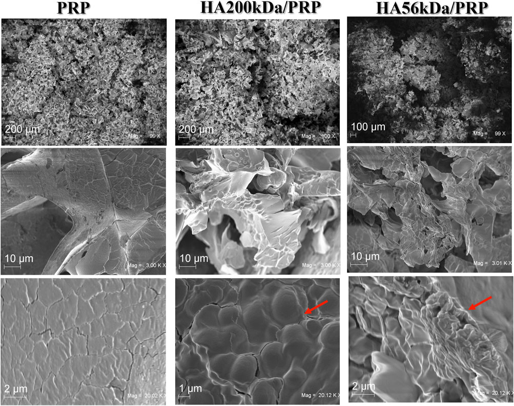Scanning electron microscope images comparing PRP, HA200kDa/PRP, and HA56kDa/PRP. The first row shows broader views with varying scales: 200 micrometers and 100 micrometers. The second row, at 10 micrometers scale, highlights textured surfaces. The third row focuses on finer details with scales ranging from 1 to 2 micrometers, with red arrows indicating specific textural features.