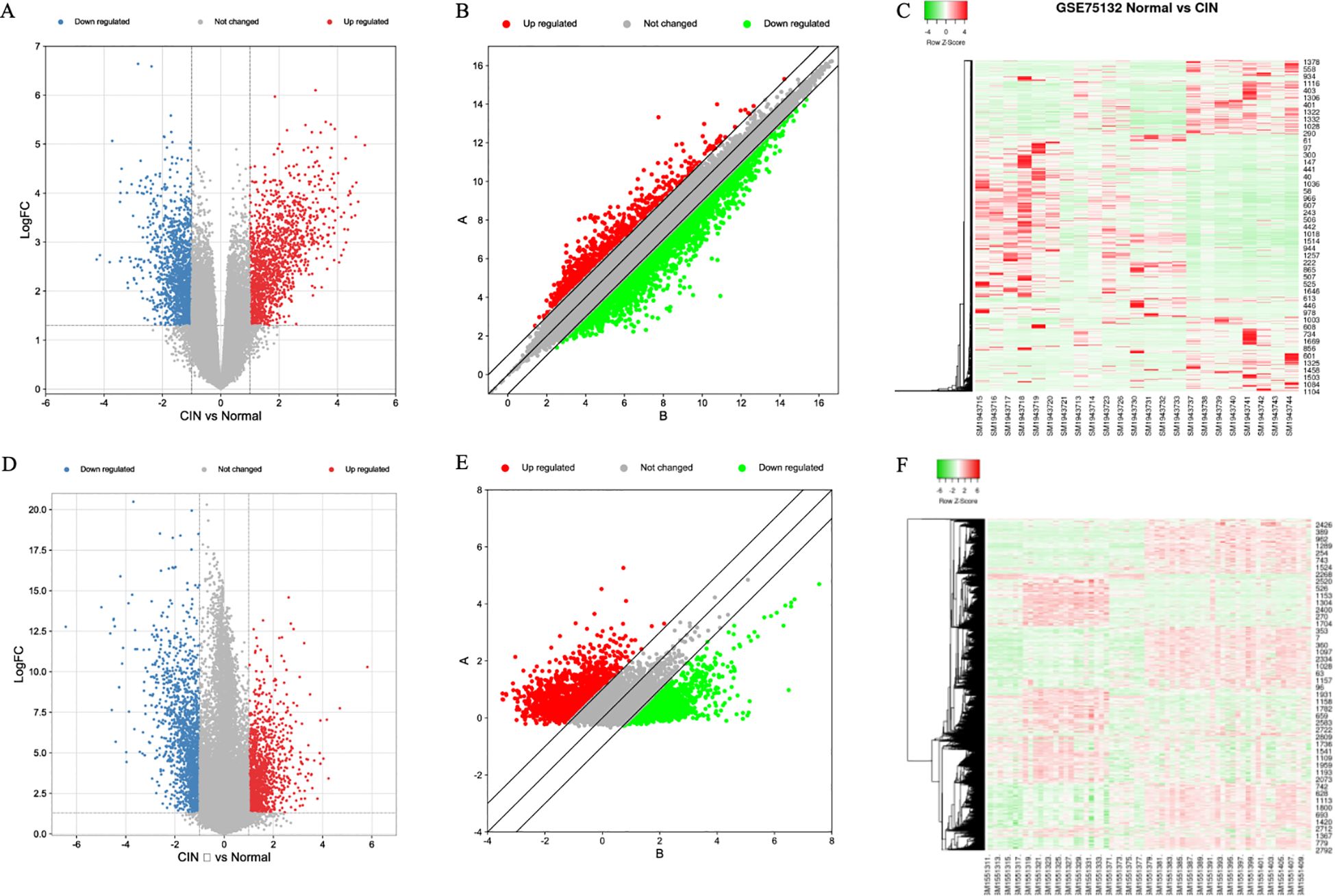 Panel of six images analyzing gene expression data. A and D are volcano plots showing upregulated (red) and downregulated (blue) genes in CIN versus normal samples, labeled “LogFC” against a zero baseline. B and E are MA plots with upregulated (red) and downregulated (green) genes, displaying gene expression distribution. C and F are heatmaps with hierarchical clustering, showing differential expression patterns between GSE75132 normal and CIN samples. The color gradient indicates expression levels from green (low) to red (high).