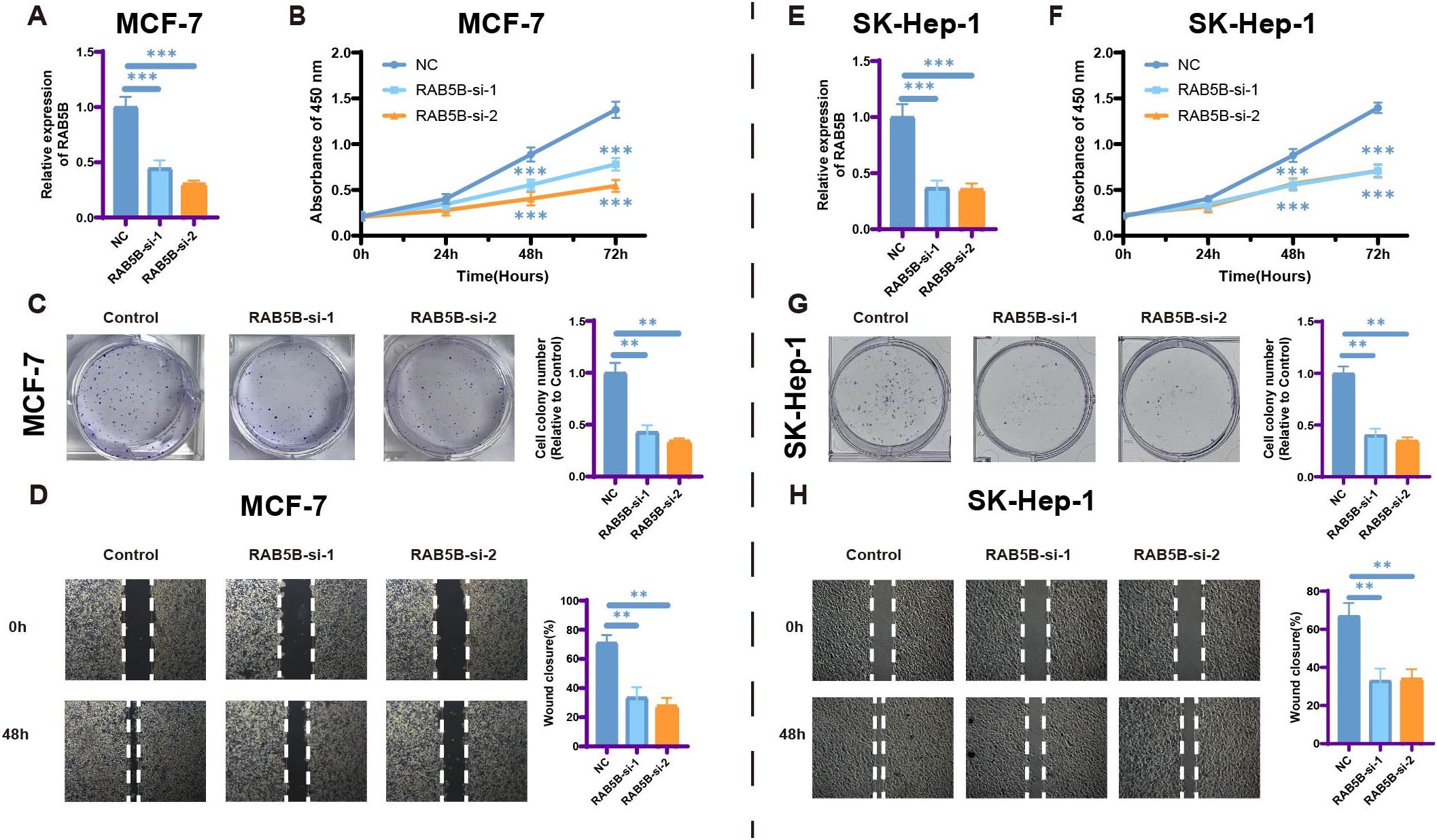 Charts and images display RAB5B expression and effects in MCF-7 and SK-Hep-1 cells. (A, E) Bar graphs show RAB5B expression, higher in NC than RAB5B-si-1 and RAB5B-si-2. (B, F) Line graphs depict cell viability over time, higher in NC. (C, G) Colony formation assays indicate fewer colonies in RAB5B-si samples. (D, H) Wound healing assays show reduced wound closure in RAB5B-si samples. Results highlight significant differences, indicated by stars.