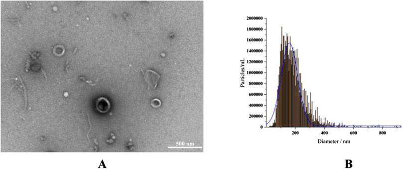 Panel A shows a transmission electron microscopy (TEM) image of nanoparticles on a gray background with varying shapes and sizes, including spherical and irregular forms. Panel B is a histogram depicting the size distribution of these nanoparticles, with particle count on the y-axis and diameter in nanometers on the x-axis. The distribution peaks around 100 to 150 nanometers.
