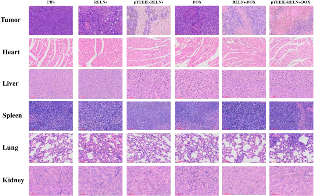 Histological images of tissues (tumor, heart, liver, spleen, lung, kidney) treated with various substances: PBS, RELNs, pYEEIE-RELNs, DOX, RELNs-DOX, and pYEEIE-RELNs-DOX. Each treatment shows different tissue morphology and staining patterns under the microscope.