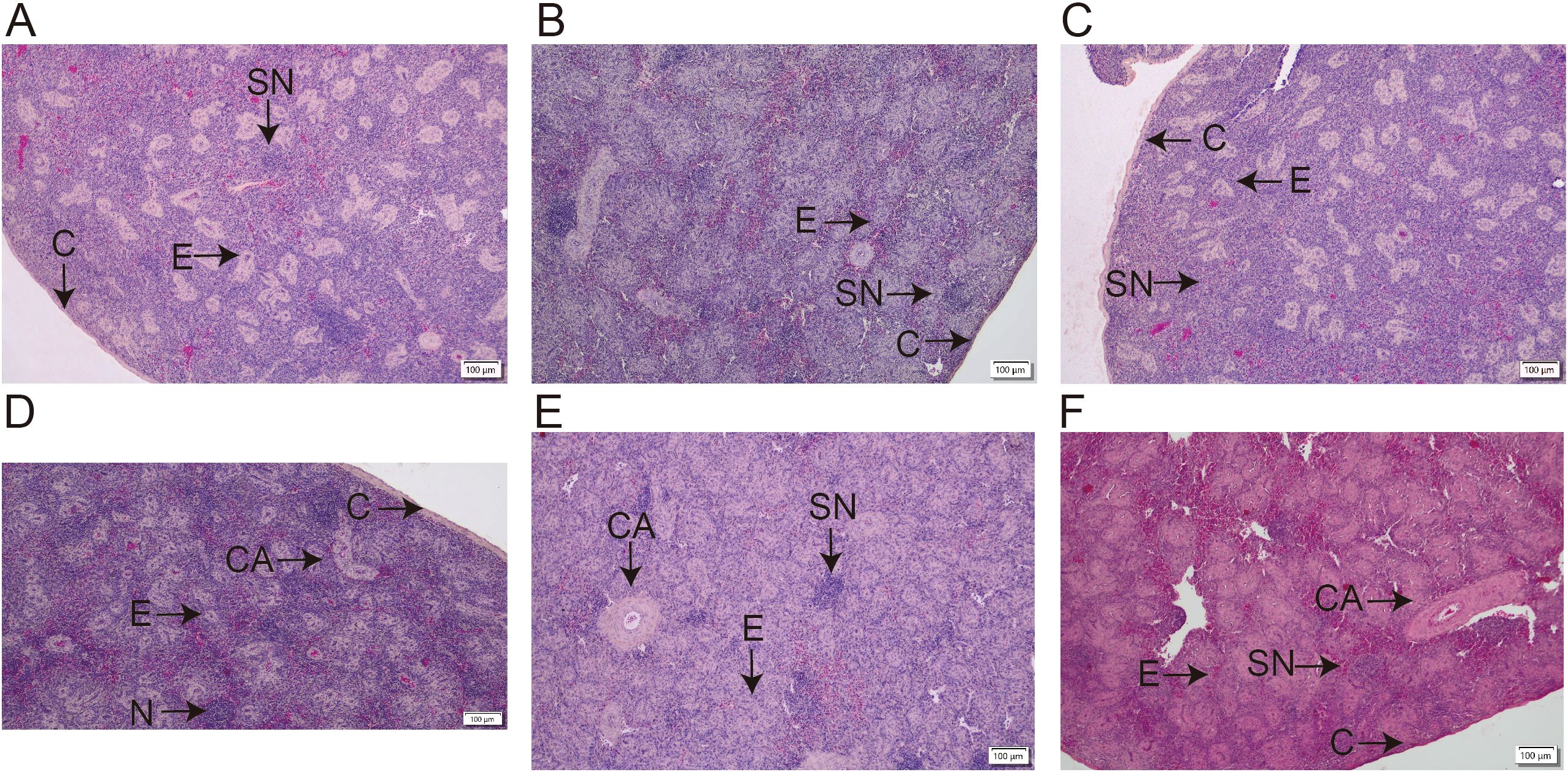 Microscopic images labeled A to F showing sections of tissue with annotations. Labels include C (capsule), SN (sinus), E (epithelial cells), CA (capillaries), and N (node). Each image highlights different components with variations in tissue structure and staining, marked with arrows. The scale bar indicates one hundred micrometers for reference.