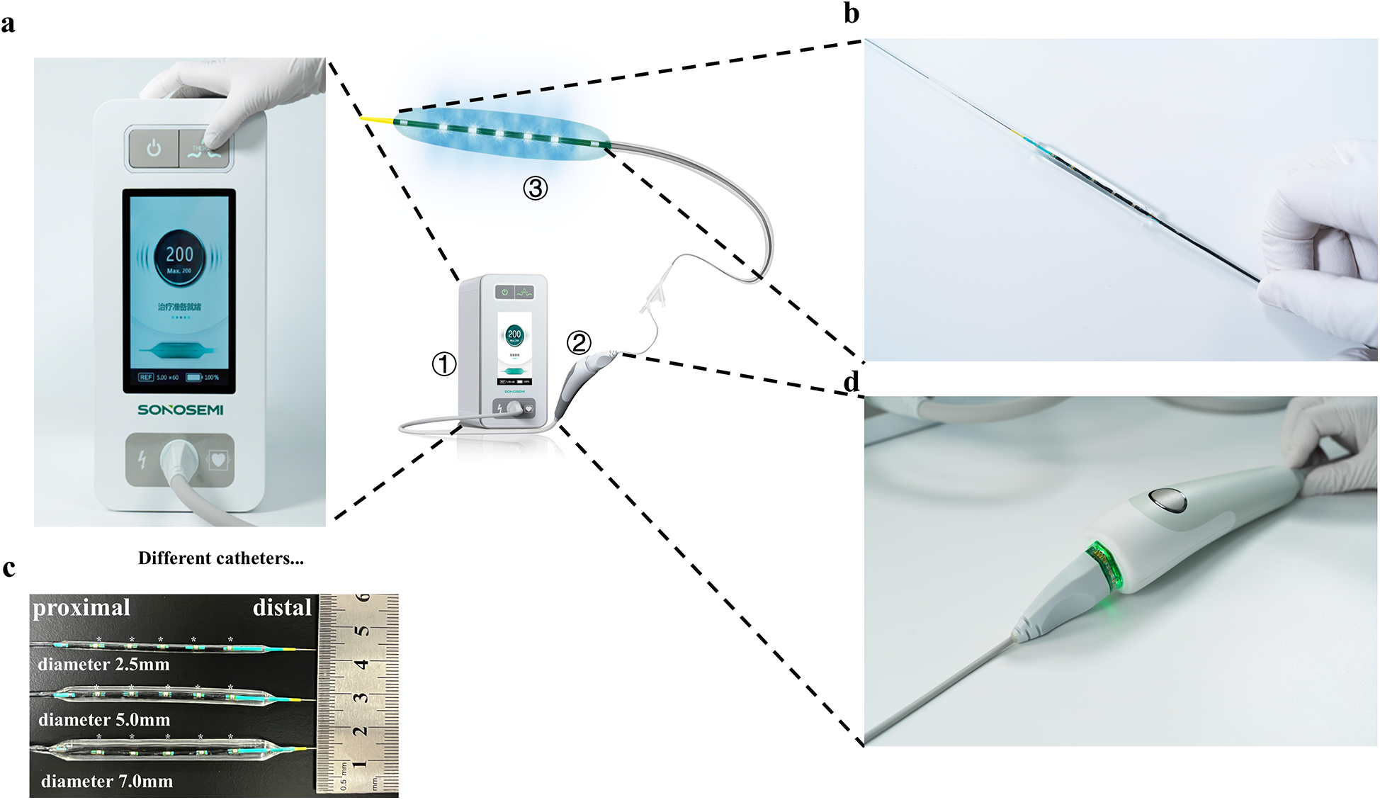 Medical device setup with four images: a control unit with a touch screen labeled \"SONOSEMI,\" a close-up of a catheter, three catheters with different diameters (2.5 mm, 5.0 mm, 7.0 mm) alongside a ruler, and a handheld device with a glowing indicator in use.
