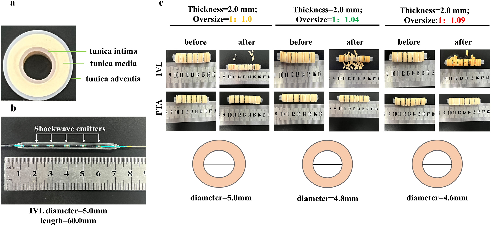 Cross-sectional view of an artery showing tunica intima, media, and adventitia. A shockwave emitter catheter with a diameter of five millimeters and length of sixty millimeters is depicted with measurements. Before and after images of artery testing show the effects of various oversize ratios on the artery structure, labeled IVL and PTA, with specific diameters and oversize values.