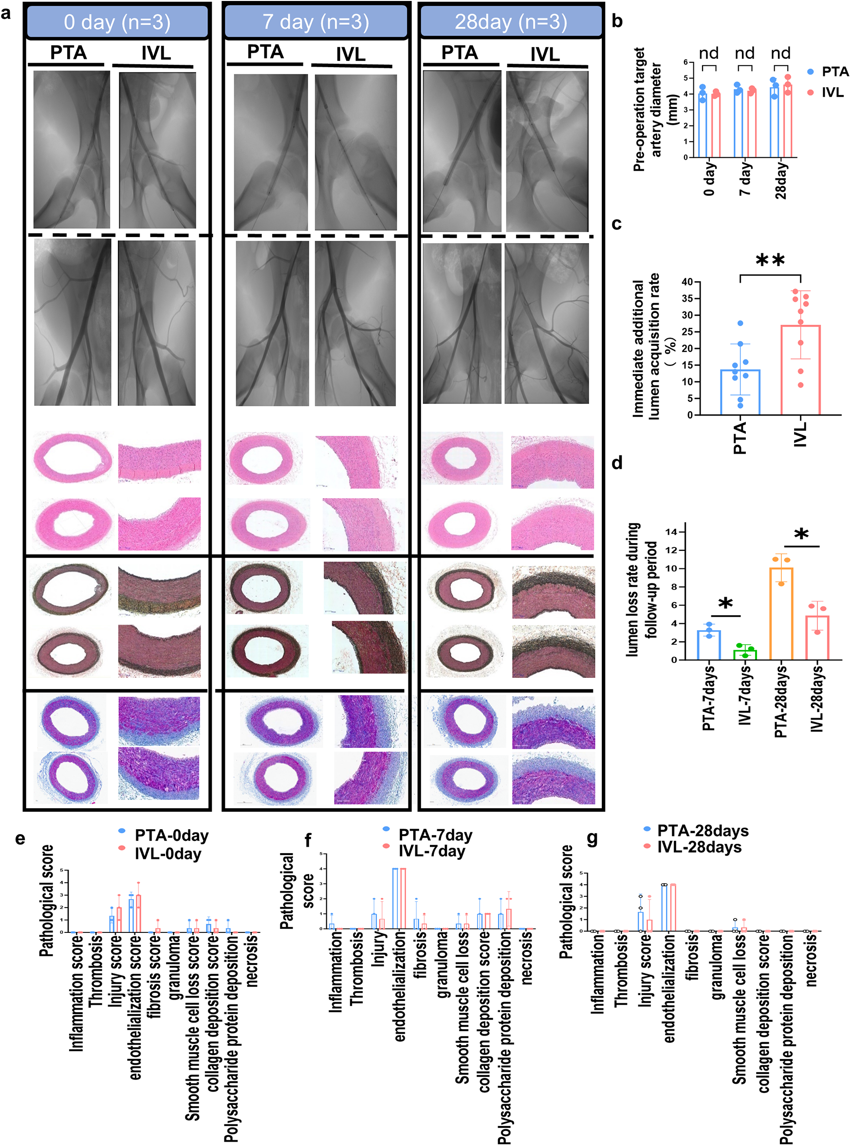 A multi-panel scientific image shows angiographic and histological comparisons between PTA (percutaneous transluminal angioplasty) and IVL (intravascular lithotripsy) treatments over three time points: 0, 7, and 28 days. Panel (a) includes angiograms and histological cross-sections of arteries. Graphs (b-g) display measurements such as artery diameter, lumen acquisition rate, and pathological scores. Results highlight differences in arterial changes over time, with statistical significance indicated by asterisks. Each panel is labeled with specific time and treatment details.