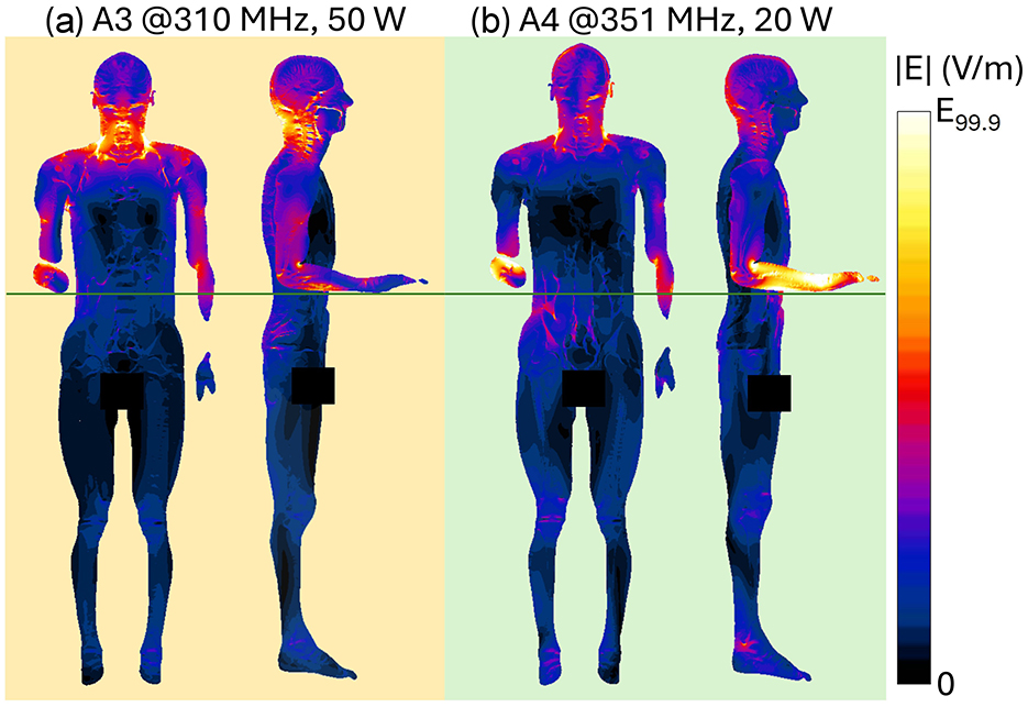 Two thermal images of human figures showing electric field distribution. Left image labeled “A3 @310 MHz, 50 W” and right image labeled “A4 @351 MHz, 20 W.” Both figures are colored from blue to red, indicating varying field intensities, with a color scale on the right ranging from 0 V/m to the value of the 99.9th percentile of the E-field distribution.